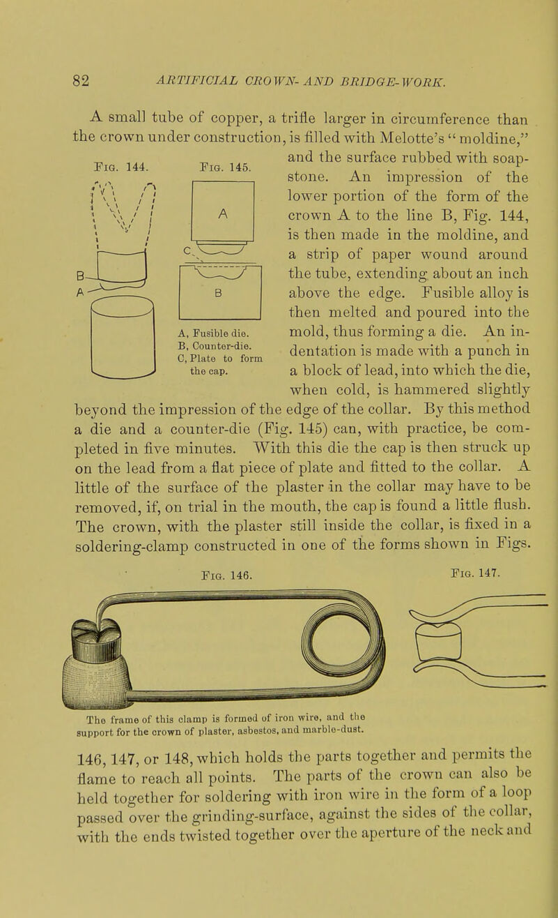 Fig. 144. Pig. 145. ' 1 I v 1 A small tube of copper, a trifle larger in circumference than the crown under construction, is filled with Melotte's  moldine, and the surface rubbed with soap- stone. An impression of the lower portion of the form of the crown A to the line B, Fig. 144, is then made in the moldine, and a strip of paper wound around the tube, extending about an inch above the edge. Fusible alloy is then melted and poured into the mold, thus forming a die. An in- dentation is made with a punch in a block of lead, into which the die, when cold, is hammered slightly beyond the impression of the edge of the collar. By this method a die and a counter-die (Fig. 145) can, with practice, be com- pleted in five minutes. With this die the cap is then struck up on the lead from a flat piece of plate and fitted to the collar. A little of the surface of the plaster in the collar may have to be removed, if, on trial in the mouth, the cap is found a little flush. The crown, with the plaster still inside the collar, is fixed in a soldering-clamp constructed in one of the forms shown in Figs. A, Fusible die. B, Counter-die. C, Plate to form the cap. Fig. 146. Fig. 147. The frame of this clamp is formed of iron wire, and the support for the crown of plaster, asbestos, and marble-dust. 146,147, or 148, which holds the parts together and permits the flame to reach all points. The parts of the crown can also be held together for soldering with iron wire in the form of a loop passed over the grin ding-surface, against the sides of the collar, with the ends twisted together over the aperture of the neck and