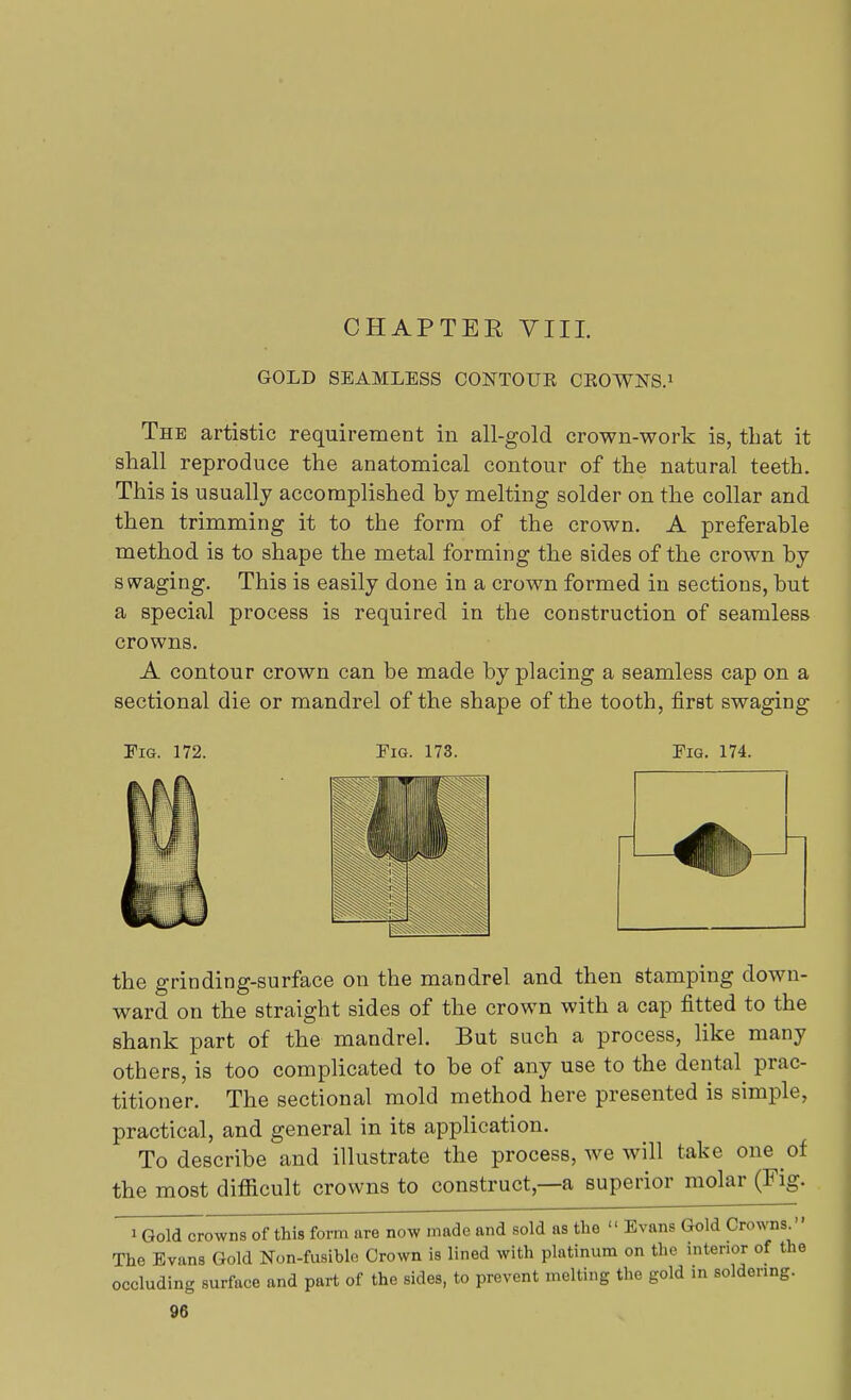 C HAP TEE VIII. GOLD SEAMLESS CONTOUK CEOWNS.1 The artistic requirement in all-gold crown-work is, that it shall reproduce the anatomical contour of the natural teeth. This is usually accomplished by melting solder on the collar and then trimming it to the form of the crown. A preferable method is to shape the metal forming the sides of the crown by swaging. This is easily done in a crown formed in sections, but a special process is required in the construction of seamless crowns. A contour crown can be made by placing a seamless cap on a sectional die or mandrel of the shape of the tooth, first swaging Fig. 172. Fig. 173. Fig. 174. the grinding-surface on the mandrel and then stamping down- ward on the straight sides of the crown with a cap fitted to the shank part of the mandrel. But such a process, like many others, is too complicated to be of any use to the dental^ prac- titioner. The sectional mold method here presented is simple, practical, and general in its application. To describe and illustrate the process, we will take one of the most difficult crowns to construct,—a superior molar (Fig. iQold crowns of this form are now made and sold as the  Evans Gold Crowns. The Evans Gold Non-fusible Crown is lined with platinum on the interior of the occluding surface and part of the sides, to prevent melting the gold in soldering.