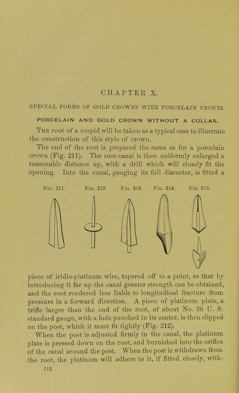 CHAP TEE X. SPECIAL FORMS OF GOLD CROWNS WITH PORCELAIN FRONTS. PORCELAIN AND GOLD CROWN WITHOUT A COLLAR. The root of a cuspid will be taken as a typical case to illustrate the construction of this style of crown. The end of the root is prepared the same as for a porcelain crown (Fig. 211). The root-canal is then uniformly enlarged a reasonable distance up, with a drill which will closely fit the opening. Into the canal, gauging its full diameter, is fitted a Fig. 211. Fto. 212. Fig. 213. Fig. 214. Fig. 215. piece of iridio-platinum wire, tapered off to a point, so that by introducing it far up the canal greater strength can be obtained, and the root rendered less liable to longitudinal fracture from pressure in a forward direction. Apiece of platinum plate, a trifle larger than the end of the root, of about No. 30 U. S. standard gauge, with a hole punched in its center, is then slipped on the post, which it must fit tightly (Fig. 212). When the post is adjusted firmly in the canal, the platinum plate is pressed down on the root, and burnished into the orifice of the canal around the post. When the post is withdrawn from the root, the platinum will adhere to it, if fitted closely, with-