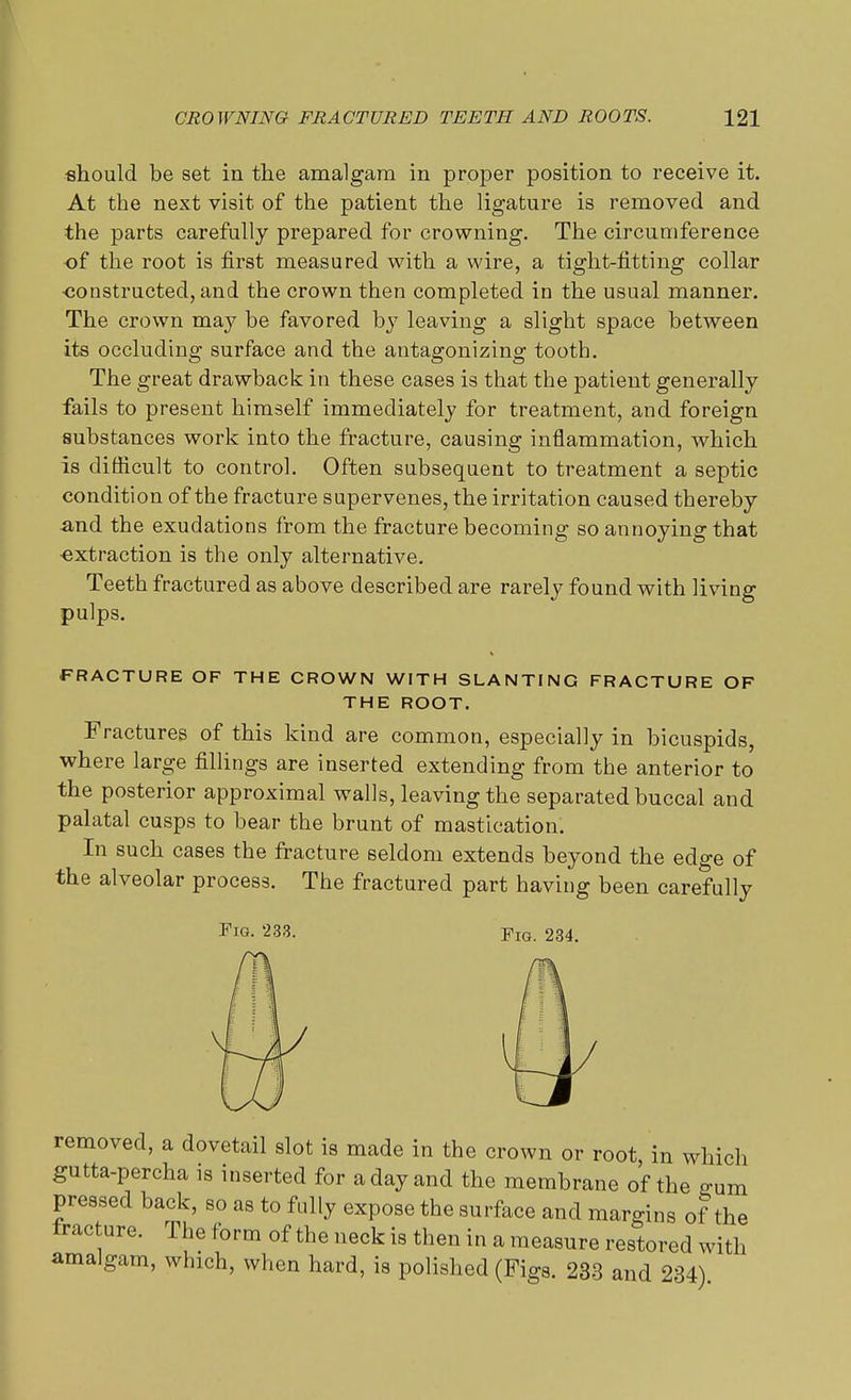 should be set in the amalgam in proper position to receive it. At the next visit of the patient the ligature is removed and the parts carefully prepared for crowning. The circumference of the root is first measured with a wire, a tight-fitting collar •constructed, and the crown then completed in the usual manner. The crown may be favored by leaving a slight space between its occluding surface and the antagonizing tooth. The great drawback in these cases is that the patient generally fails to present himself immediately for treatment, and foreign substances work into the fracture, causing inflammation, which is difficult to control. Often subsequent to treatment a septic condition of the fracture supervenes, the irritation caused thereby and the exudations from the fracture becoming so annoying that extraction is the only alternative. Teeth fractured as above described are rarely found with living pulps. FRACTURE OF THE CROWN WITH SLANTING FRACTURE OF THE ROOT. Fractures of this kind are common, especially in bicuspids, where large fillings are inserted extending from the anterior to the posterior approximal walls, leaving the separated buccal and palatal cusps to bear the brunt of mastication. In such cases the fracture seldom extends beyond the edge of the alveolar process. The fractured part having been carefully Fig. 233. pIG. 234. removed, a dovetail slot is made in the crown or root in which gutta-percha is inserted for a day and the membrane of the gum pressed back, so as to fully expose the surface and margins of the fracture. The form of the neck is then in a measure restored with amalgam, which, when hard, is polished (Figs. 233 and 234)