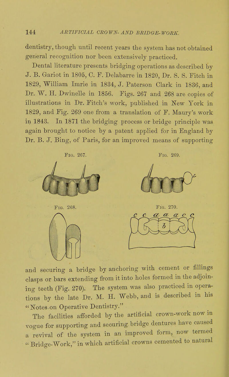 dentistry, though until recent years the system has not obtained general recognition nor been extensively practiced. Dental literature presents bridging operations as described by J. B. Gariot in 1805, C. F. Delabarre in 1820, Dr. S. S. Fitch in 1829, William Imrie in 1834, J. Paterson Clark in 1836, and Dr. W. H. Dwindle in 1856. Figs. 267 and 268 are copies of illustrations in Dr. Fitch's work, published in New York in 1829, and Fig. 269 one from a translation of F. Maury's work in 1843. In 1871 the bridging process or bridge principle was again brought to notice by a patent applied for in England by Dr. B. J. Bing, of Paris, for an improved means of supporting Pig. 267. Fig. 269. Fig. 268. Fig. 270. a a c o and securing a bridge by anchoring with cement or fillings clasps or bars extending from it into holes formed in the adjoin- ing teeth (Fig. 270). The system was also practiced in opera- tions by the late Dr. M. H. Webb, and is described in his Notes on Operative Dentistry. The facilities afforded by the artificial crown-work now in vogue for supporting and securing bridge dentures have caused a revival of the system in an improved form, now termed « Bridge-Work, in which artificial crowns cemented to natural