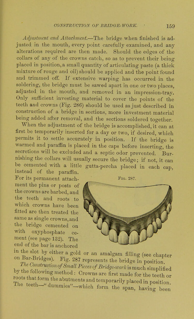 Adjustment and Attachment.—The bridge when finished is ad- justed in the mouth, every point carefully examined, and any alterations required are then made. Should the edges of the collars of any of the crowns catch, so as to prevent their being placed in position, a small quantity of articulating paste (a thick mixture of rouge and oil) should be applied and the point found and trimmed off. If extensive warping has occurred in the soldering, the bridge must be sawed apart in one or two places, adjusted in the mouth, and removed in an impression-tray. Only sufficient investing material to cover the points of the teeth and crowns (Pig. 286) should be used as just described in construction of a bridge in sections, more investment material being added after removal, and the sections soldered together. When the adjustment of the bridge is accomplished, it can at first be temporarily inserted for a day or two, if desired, which permits it to settle accurately in position. If the bridge is warmed and paraffin is placed in the caps before inserting, the secretions will be excluded and a septic odor prevented. Bur- nishing the collars will usually secure the bridge; if not, it can be cemented with a little gutta-percha placed in each cap, instead of the paraffin. ment the pins or posts of the crowns are barbed, and the teeth and roots to which crowns have been fitted are then treated the same as single crowns, and the bridge cemented on with oxyphosphate ce- ment (see page 132). The end of the bar is anchored in the slot by either a gold or an amalgam filling (see chapter on Bar Bridges). Fig. 287 represents the bridge in position The Construction of Small Pieces of Bridge-work is much simplified by the following method : Crowns are first made for the teeth or The teet'h Ti**16 abutr Qt-nd temP°ra^ Pl«ed in position, ine teeth- < dummies»_which form the span, having been