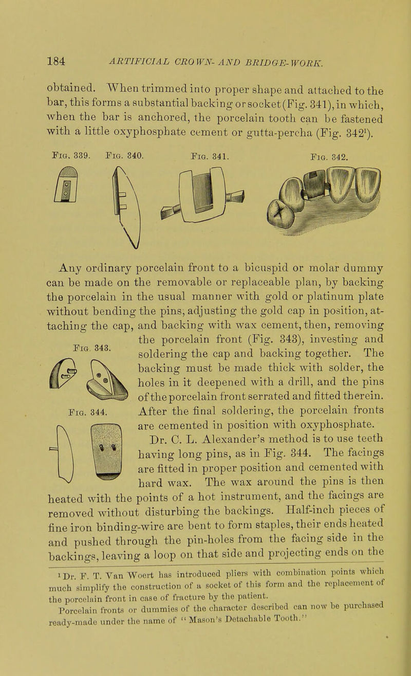 obtained. When trimmed into proper shape and attached to the bar, this forms a substantia] backi ng or socket (Fig. 341), in which, when the bar is anchored, the porcelain tooth can be fastened with a little oxyphospbate cement or gutta-percha (Fig. 3421). Pig. 339. Fig. 340. Fig. 341. Fig. 342. Fig. 343. Fig. 344. Any ordinary porcelain front to a bicuspid or molar dummy can be made on the removable or replaceable plan, by backing the porcelain in the usual manner with gold or platinum plate without bending the pins, adjusting the gold cap in position, at- taching the cap, and backing with wax cement, then, removing the porcelain front (Fig. 343), investing and soldering the cap and backing together. The backing must be made thick with solder, the holes in it deepened with a drill, and the pins of the porcelain front serrated and fitted therein. After the final soldering, the porcelain fronts are cemented in position with oxyphosphate. Dr. C. L. Alexander's method is to use teeth having long pins, as in Fig. 344. The facings are fitted in proper position and cemented with hard wax. The wax around the pins is then heated with the points of a hot instrument, and the facings are removed without disturbing the backings. Half-inch pieces of fine iron binding-wire are bent to form staples, their ends heated and pushed through the pin-holes from the facing side in the backings, leaving a loop on that side and projecting ends on the 1Dv F T. Van Woert has introduced pliers with combination points which much simplify the construction of a socket of this form and the replacement of the porcelain front in case of fracture hy the patient. Porcelain fronts or dummies of the character described can now be purchased ready-made under the name of  Mason's Detachable Tooth.