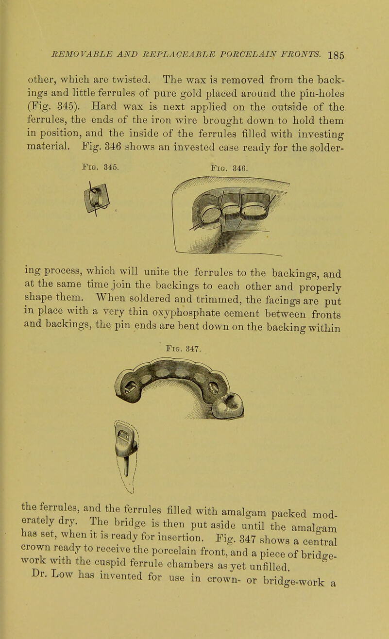 other, which are twisted. The wax is removed from the back- ings and little ferrules of pure gold placed around the pin-holes (Fig. 345). Hard wax is next applied on the outside of the ferrules, the ends of the iron wire brought down to hold them in position, and the inside of the ferrules filled with investing material. Fig. 346 shows an invested case ready for the solder- Fig. 345. Fig. 346. . — ——: ing process, which will unite the ferrules to the backings, and at the same time join the backings to each other and properly shape them. When soldered and trimmed, the facings are put in place with a very thin oxyphosphate cement between fronts and backings, the pin ends are bent down on the backing within Fig. 347. the ferrules, and the ferrules filled with amalgam packed mod- erately dry. The bridge is then put aside until the amalgam has set, when it is ready for insertion. Fig. 347 shows a central crown ready to receive the porcelain front, and a piece of bridge- work with the cuspid ferrule chambers as yet unfilled Dr. Low has invented for use in crown- or bridge-work a