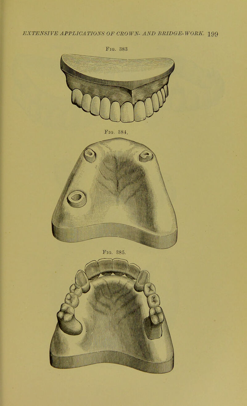 Fig. 383