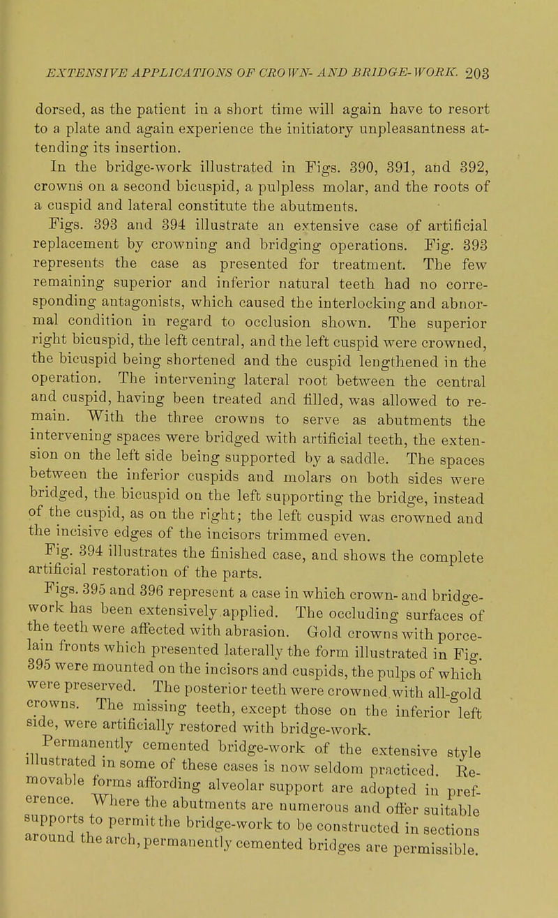 dorsed, as the patient in a short time will again have to resort to a plate and again experience the initiatory unpleasantness at- tending its insertion. In the bridge-work illustrated in Figs. 390, 391, and 392, crowns on a second bicuspid, a pulpless molar, and the roots of a cuspid and lateral constitute the abutments. Figs. 393 and 394 illustrate an extensive case of artificial replacement by crowning and bridging operations. Fig. 393 represents the case as presented for treatment. The few remaining superior and inferior natural teeth had no corre- sponding antagonists, which caused the interlocking and abnor- mal condition in regard to occlusion shown. The superior right bicuspid, the left central, and the left cuspid were crowned, the bicuspid being shortened and the cuspid lengthened in the operation. The intervening lateral root between the central and cuspid, having been treated and filled, was allowed to re- main. With the three crowns to serve as abutments the intervening spaces were bridged with artificial teeth, the exten- sion on the left side being supported by a saddle. The spaces between the inferior cuspids and molars on both sides were bridged, the bicuspid on the left supporting the bridge, instead of the cuspid, as on the right; the left cuspid was crowned and the incisive edges of the incisors trimmed even. Fig. 394 illustrates the finished case, and shows the complete artificial restoration of the parts. Figs. 395 and 396 represent a case in which crown- and bridge- work has been extensively.applied. The occluding surfaces^of the teeth were affected with abrasion. Gold crowns with porce- lain fronts which presented laterally the form illustrated in Fig. 395 were mounted on the incisors and cuspids, the pulps of which were preserved. The posterior teeth were crowned with all-o-old crowns. The missing teeth, except those on the inferior left side, were artificially restored with bridge-work. Permanently cemented bridge-work of the extensive style illustrated m some of these cases is now seldom practiced Re- movable forms affording alveolar support are adopted in pref- erence. Where the abutments are numerous and offer suitable PTit the bridSe-work t0 ^ constructed in sections around the arch, permanently cemented bridges are permissible