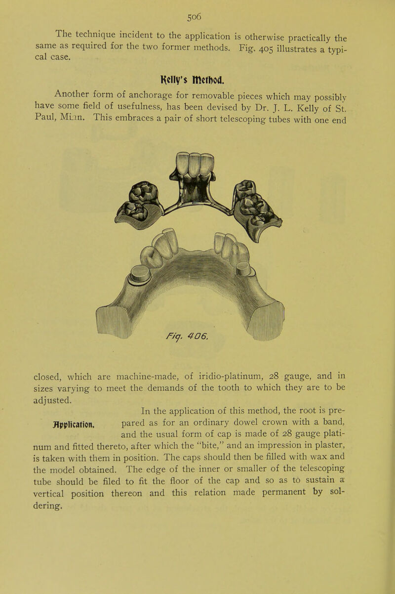 The technique incident to the application is otherwise practically the same as required for the two former methods. Fig. 405 illustrates a typi- cal case. Kelly's method. Another form of anchorage for removable pieces which may possibly have some field of usefulness, has been devised by Dr. J. L. Kelly of St. Paul, MLm. This embraces a pair of short telescoping tubes with one end closed, which are machine-made, of iridio-platinum, 28 gauge, and in sizes varying to meet the demands of the tooth to which they are to be adjusted. In the application of this method, the root is pre- Jlpplication, pared as for an ordinary dowel crown with a band, and the usual form of cap is made of 28 gauge plati- num and fitted thereto, after which the bite, and an impression in plaster, is taken with them in position. The caps should then be filled with wax and the model obtained. The edge of the inner or smaller of the telescoping tube should be filed to fit the floor of the cap and so as to sustain a vertical position thereon and this relation made permanent by sol- dering.