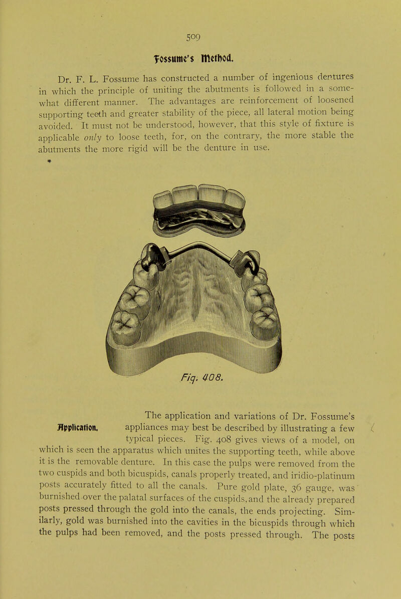 Tossumc's Flletbod. Dr. F. L. Fossume has constructed a number of ingenious dentures in which the principle of uniting the abutments is followed in a some- what different manner. The advantages are reinforcement of loosened supporting teeth and greater stability of the piece, all lateral motion being avoided. It must not be understood, however, that this style of fixture is applicable only to loose teeth, for, on the contrary, the more stable the abutments the more rigid will be the denture in use. The application and variations of Dr. Fossume's Application, appliances may best be described by illustrating a few ( typical pieces. Fig. 408 gives views of a model, on which is seen the apparatus which unites the supporting teeth, while above it is the removable denture. In this case the pulps were removed from the two cuspids and both bicuspids, canals properly treated, and iridio-platinum posts accurately fitted to all the canals. Pure gold plate, 36 gauge, was burnished over the palatal surfaces of the cuspids,and the already prepared posts pressed through the gold into the canals, the ends projecting. Sim- ilarly, gold was burnished into the cavities in the bicuspids through which the pulps had been removed, and the posts pressed through. The posts