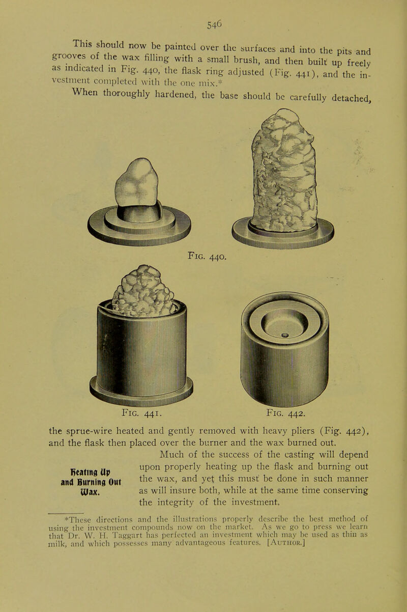 Th1S should now be painted over the surfaces and into the pits and grooves of the wax filling with a small brush, and then built up freely as indicated in Fig. 440, the flask ring adjusted (Fig. 441), and the in- vestment completed with the one mix.* When thoroughly hardened, the base should be carefully detached Fig. 440. Fig. 441. Fig. 442. the sprue-wire heated and gently removed with heavy pliers (Fig. 442), and the flask then placed over the burner and the wax burned out. Much of the success of the casting will depend upon properly heating up the flask and burning out the wax, and yet this must' be done in such manner as will insure both, while at the same time conserving the integrity of the investment. Beating Up and Burning Out Ulax. *These directions and the illustrations properly describe the host method of using the investment compounds now on the market. As we go to press we learn that Dr. W. II. Taggart has perfected an investment which may Ik- used as thin as milk, and which possesses many advantageous features. [Author.]