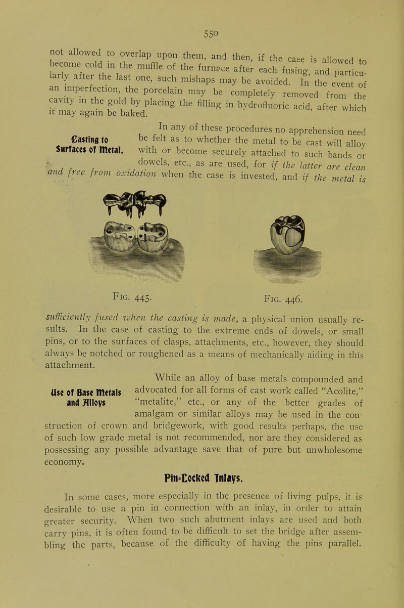 55° not allowed to overlap upon them, and then, if the ca=e is allows »„ become cold in the muffle of the furnace after each fusing and » ticu larly after the last one, such mishaps may be avoided. In the e an imperfection the porcelain may be completely removed from the cavity ,„ the gold by placing the filling i„ hydrofluoric acid, after wh 1 it may again be baked. In any of these procedures no apprehension need Casting to be felt as to whether the metal to be cast will alloy Surfaces Of Ittetal. with or become securely attached to such bands or , , s d°wds' etc-' as are used> f°r if the latter are clean and free from oxidation when the case is invested, and if the metal is Fig. 445. Fig. 446. sufficiently fused when the casting is made, a physical union usually re- sults. In the case of casting to the extreme ends of dowels, or small pins, or to the surfaces of clasps, attachments, etc., however, they should always be notched or roughened as a means of mechanically aiding in this attachment. While an alloy of base metals compounded and Use Of Base ItletalS advocated for all forms of cast work called Acolite, anfl Alloys metalite, etc., or any of the better grades of amalgam or similar alloys may be used in the con- struction of crown and bridgework, with good results perhaps, the use of such low grade metal is not recommended, nor are they considered as possessing any possible advantage save that of pure but unwholesome economy. Pin Locked inlays. In some cases, more especially in the presence of living pulps, it is desirable to use a pin in connection with an inlay, in order to attain greater security. When two such abutment inlays are used and both carry pins, it is often found to be difficult to set the bridge after assem- bling the parts, because of the difficulty of having the pins parallel.