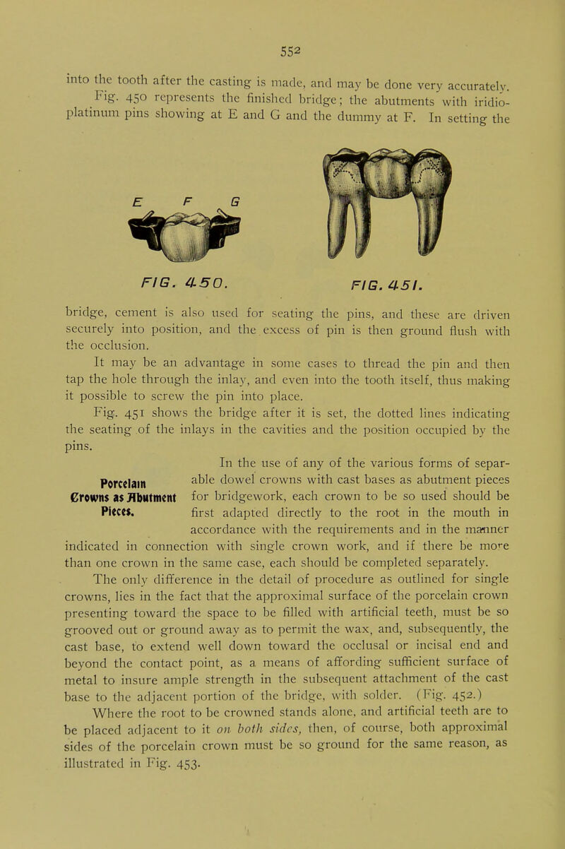 into the tooth after the casting is made, and may be done very accurately. Fig. 450 represents the finished bridge; the abutments with iridio- platinum pins showing at E and G and the dummy at F. In setting the FIG. £1.50. fig. £151. bridge, cement is also used for seating the pins, and these are driven securely into position, and the . excess of pin is then ground flush with the occlusion. It may be an advantage in some cases to thread the pin and then tap the hole through the inlay, and even into the tooth itself, thus making it possible to screw the pin into place. Fig. 451 shows the bridge after it is set, the dotted lines indicating die seating of the inlays in the cavities and the position occupied by the pins. In the use of any of the various forms of separ- Porcdaitt a^e dowel crowns with cast bases as abutment pieces Crowns as Abutment for bridgework, each crown to be so used should be PiCCCS. first adapted directly to the root in the mouth in accordance with the requirements and in the manner indicated in connection with single crown work, and if there be mce than one crown in the same case, each should be completed separately. The only difference in the detail of procedure as outlined for single crowns, lies in the fact that the approximal surface of the porcelain crown presenting toward the space to be filled with artificial teeth, must be so grooved out or ground away as to permit the wax, and, subsequently, the cast base, to extend well down toward the occlusal or incisal end and beyond the contact point, as a means of affording sufficient surface of metal to insure ample strength in the subsequent attachment of the cast base to the adjacent portion of the bridge, with solder. (Fig. 452.) Where the root to be crowned stands alone, and artificial teeth are to be placed adjacent to it on both sides, then, of course, both approximal sides of the porcelain crown must be so ground for the same reason, as illustrated in Fig. 453.