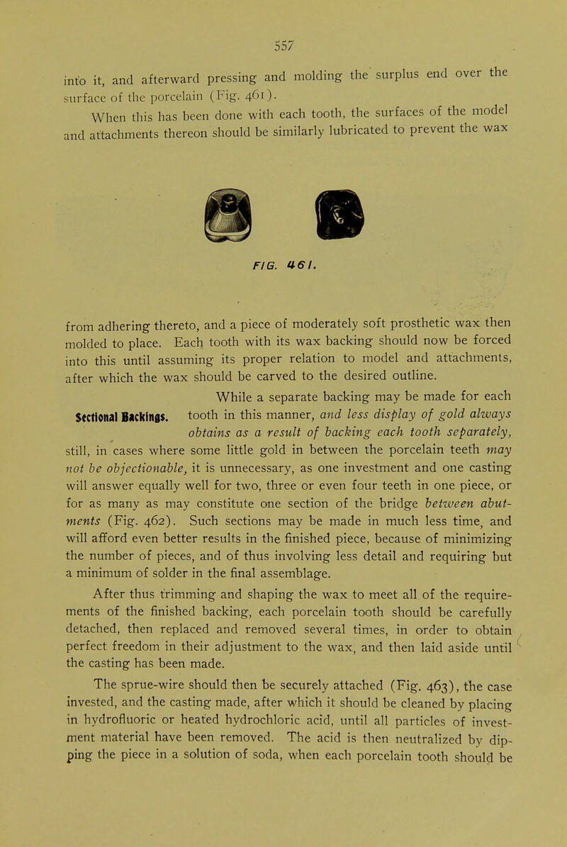 into it, and afterward pressing and molding the surplus end over the surface of the porcelain (Fig. 461). When this has been done with each tooth, the surfaces of the model and attachments thereon should be similarly lubricated to prevent the wax FIB. 461. from adhering thereto, and a piece of moderately soft prosthetic wax then molded to place. Each tooth with its wax backing should now be forced into this until assuming its proper relation to model and attachments, after which the wax should be carved to the desired outline. While a separate backing may be made for each Sectional Backings, tooth in this manner, and less display of gold always obtains as a result of backing each tooth separately, still, in cases where some little gold in between the porcelain teeth may not be objectionable, it is unnecessary, as one investment and one casting will answer equally well for two, three or even four teeth in one piece, or for as many as may constitute one section of the bridge between abut- ments (Fig. 462). Such sections may be made in much less time, and will afford even better results in the finished piece, because of minimizing the number of pieces, and of thus involving less detail and requiring but a minimum of solder in the final assemblage. After thus trimming and shaping the wax to meet all of the require- ments of the finished backing, each porcelain tooth should be carefully detached, then replaced and removed several times, in order to obtain perfect freedom in their adjustment to the wax, and then laid aside until the casting has been made. The sprue-wire should then be securely attached (Fig. 463), the case invested, and the casting made, after which it should be cleaned by placing in hydrofluoric or heated hydrochloric acid, until all particles of invest- ment material have been removed. The acid is then neutralized by dip- ping the piece in a solution of soda, when each porcelain tooth should be