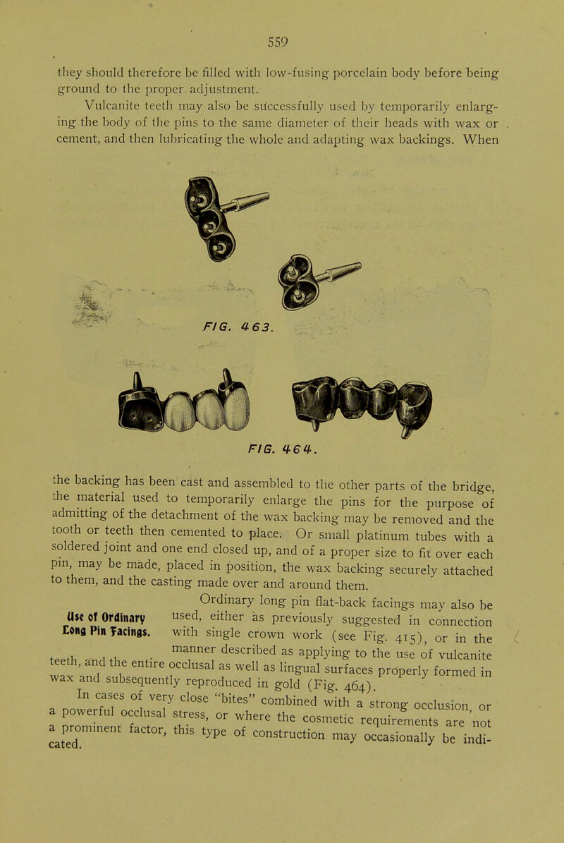 they should therefore be filled with low-fusing porcelain body before being ground to the proper adjustment. Vulcanite teeth may also be successfully used by temporarily enlarg- ing the body of the pins to the same diameter of their heads with wax or cement, and then lubricating the whole and adapting wax backings. When 4, FIG. a 63. 3Tf FIG. H-64. the backing has been cast and assembled to the other parts of the bridge, the material used to temporarily enlarge the pins for the purpose of admitting of the detachment of the wax backing may be removed and the tooth or teeth then cemented to place. Or small platinum tubes with a soldered joint and one end closed up, and of a proper size to fit over each pin, may be made, placed in position, the wax backing securely attached to them, and the casting made over and around them. Ordinary long pin flat-back facings may also be U$e Of Ordinary used, either as previously suggested in connection Eoitfl Pill facings. with single crown work (see Fig. 415), or in the w, • mannCr described as applying to the use of vulcanite teeth, and the entire occlusal as well as lingual surfaces properly formed in wax and subsequently reproduced in gold (Fig 464) In cases of very close bites combined with a strong occlusion or a powerful occlusal stress, or where the cosmetic requirements ae no a promment factor, this type of construction may occasionally be indi