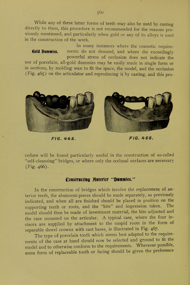 While any of these latter forms of teeth may also be used by casting directly to them, this procedure is not recommended for the reasons pre- viously mentioned, and particularly when gold or any of its alloys is used in the construction of the work. In many instances where the cosmetic require- 6old Dummies. ments do not demand, and where the exceedingly powerful stress of occlusion does not indicate the use of porcelain, all-gold dummies may be easily made in single form or in sections, by molding wax to fit the space, the model, and the occlusion (Fig. 465) on the articulator and reproducing it by casting, and this pro- FIG. U-65. FIG. 466. cedure will be found particularly useful in the construction of so-called self-cleansing bridges, or where only the occlusal surfaces are necessary (Fig. 466). Constructing Anterior Dummies. In the construction of bridges which involve the replacement of an- terior teeth, the abutment-pieces should be made separately, as previously indicated, and when all are finished should be placed in position on the supporting teeth or roots, and the bite and impression taken. The model should then be made of investment material, the bite adjusted and the case mounted on the articular. A typical case, where the four in- cisors are supplied by attachment to the cuspid root's in the form of separable dowel crowns with cast bases, is illustrated in Fig. 467. The type of porcelain tooth which seems best adapted to the require- ments of the case at hand should now be selected and ground to fit the model and to otherwise conform to the requirements. Wherever possible, some form of replaceable tooth or facing should be given the preference