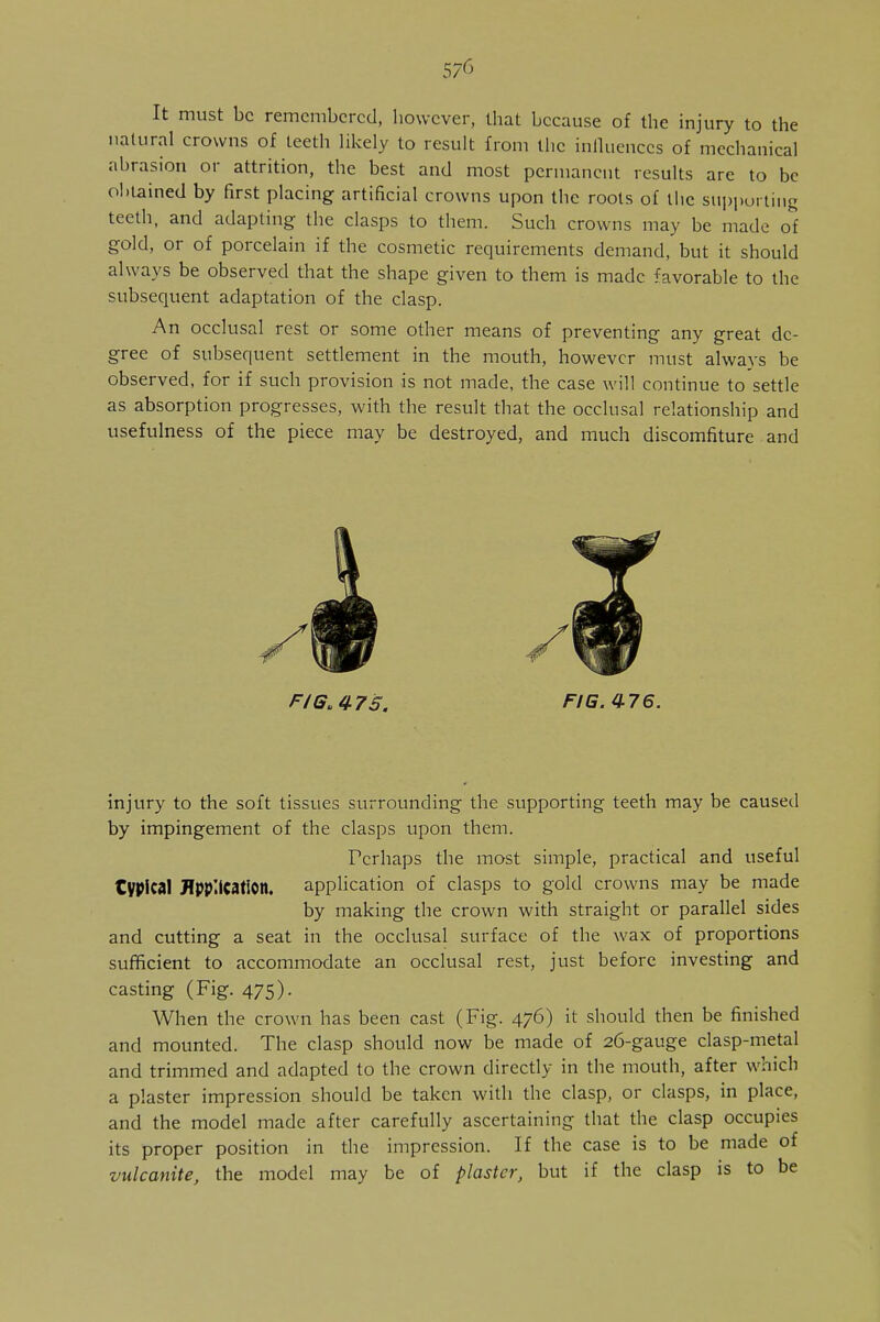 It must be remembered, however, that because of the injury to the natural crowns of teeth likely to result from the influences of mechanical abrasion or attrition, the best and most permanent results are to be obtained by first placing artificial crowns upon the roots of the supporting teeth, and adapting the clasps to them. Such crowns may be made of gold, or of porcelain if the cosmetic requirements demand, but it should always be observed that the shape given to them is made favorable to the subsequent adaptation of the clasp. An occlusal rest or some other means of preventing any great de- gree of subsequent settlement in the mouth, however must always be observed, for if such provision is not made, the case will continue to settle as absorption progresses, with the result that the occlusal relationship and usefulness of the piece may be destroyed, and much discomfiture and F/G.475. FIG. 476. injury to the soft tissues surrounding the supporting teeth may be caused by impingement of the clasps upon them. Perhaps the most simple, practical and useful typical Application. application of clasps to gold crowns may be made by making the crown with straight or parallel sides and cutting a seat in the occlusal surface of the wax of proportions sufficient to accommodate an occlusal rest, just before investing and casting (Fig. 475). When the crown has been cast (Fig. 476) it should then be finished and mounted. The clasp should now be made of 26-gauge clasp-metal and trimmed and adapted to the crown directly in the mouth, after which a plaster impression should be taken with the clasp, or clasps, in place, and the model made after carefully ascertaining that the clasp occupies its proper position in the impression. If the case is to be made of vulcanite, the model may be of plaster, but if the clasp is to be