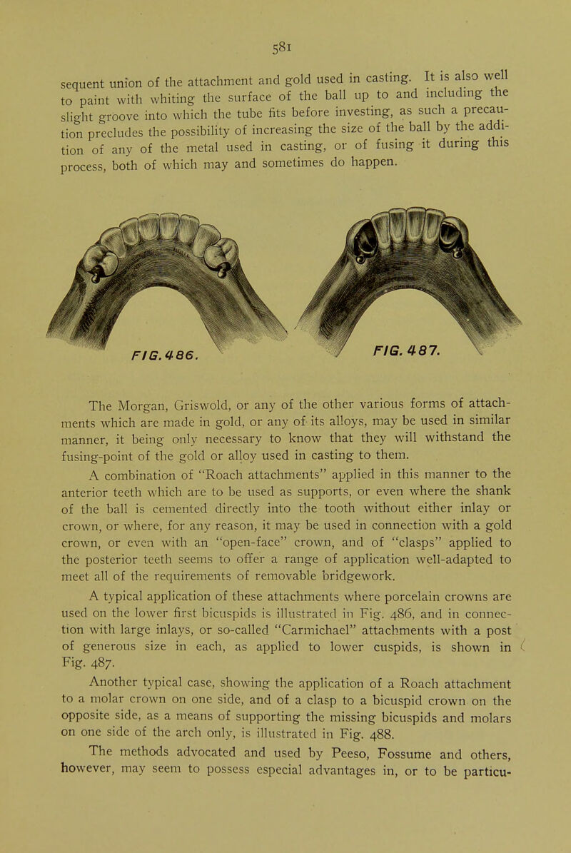 sequent union of the attachment and gold used in casting. It is also well to paint with whiting the surface of the ball up to and including the slight groove into which the tube fits before investing, as such a precau- tion precludes the possibility of increasing the size of the ball by the addi- tion of any of the metal used in casting, or of fusing it during this process, both of which may and sometimes do happen. FIG. 4 86. The Morgan, Griswold, or any of the other various forms of attach- ments which are made in gold, or any of its alloys, may be used in similar manner, it being only necessary to know that they will withstand the fusing-point of the gold or alloy used in casting to them. A combination of Roach attachments applied in this manner to the anterior teeth which are to be used as supports, or even where the shank of the ball is cemented directly into the tooth without either inlay or crown, or where, for any reason, it may be used in connection with a gold crown, or even with an open-face crown, and of clasps applied to the posterior teeth seems to offer a range of application well-adapted to meet all of the requirements of removable bridgework. A typical application of these attachments where porcelain crowns are used on the lower first bicuspids is illustrated in Fig. 486, and in connec- tion with large inlays, or so-called Carmichael attachments with a post of generous size in each, as applied to lower cuspids, is shown in ( Fig. 487. Another typical case, showing the application of a Roach attachment to a molar crown on one side, and of a clasp to a bicuspid crown on the opposite side, as a means of supporting the missing bicuspids and molars on one side of the arch only, is illustrated in Fig. 488. The methods advocated and used by Peeso, Fossume and others, however, may seem to possess especial advantages in, or to be particu-