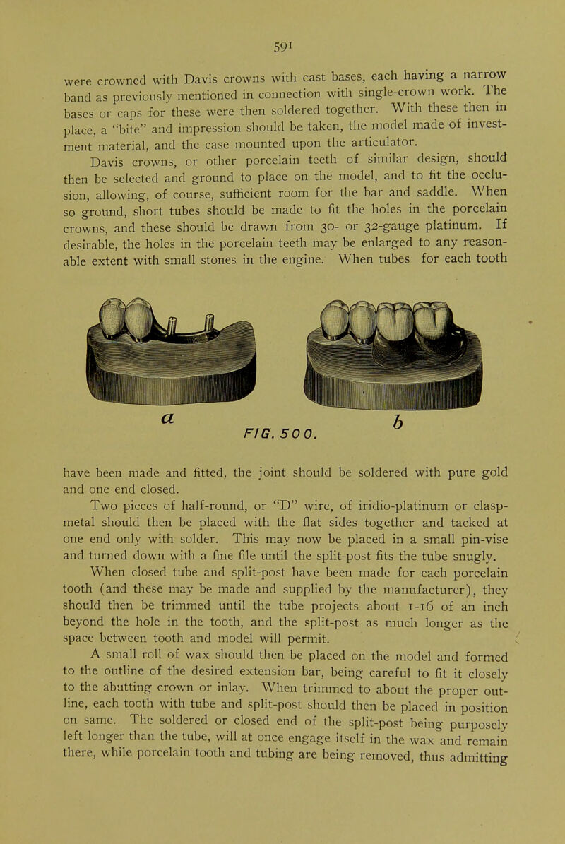 were crowned with Davis crowns with cast bases, each having a narrow hand as previously mentioned in connection with single-crown work. The bases or caps for these were then soldered together. With these then in place, a bite and impression should be taken, the model made of invest- ment material, and the case mounted upon the articulator. Davis crowns, or other porcelain teeth of similar design, should then be selected and ground to place on the model, and to fit the occlu- sion, allowing, of course, sufficient room for the bar and saddle. When so ground, short tubes should be made to fit the holes in the porcelain crowns, and these should be drawn from 30- or 32-gauge platinum. If desirable, the holes in the porcelain teeth may be enlarged to any reason- able extent with small stones in the engine. When tubes for each tooth have been made and fitted, the joint should be soldered with pure gold and one end closed. Two pieces of half-round, or D wire, of iridio-platinum or clasp- metal should then be placed with the flat sides together and tacked at one end only with solder. This may now be placed in a small pin-vise and turned down with a fine file until the split-post fits the tube snugly. When closed tube and split-post have been made for each porcelain tooth (and these may be made and supplied by the manufacturer), they should then be trimmed until the tube projects about 1-16 of an inch beyond the hole in the tooth, and the split-post as much longer as the space between tooth and model will permit. ( A small roll of wax should then be placed on the model and formed to the outline of the desired extension bar, being careful to fit it closely to the abutting crown or inlay. When trimmed to about the proper out- line, each tooth with tube and split-post should then be placed in position on same. The soldered or closed end of the split-post being purposely left longer than the tube, will at once engage itself in the wax and remain there, while porcelain tooth and tubing are being removed, thus admitting