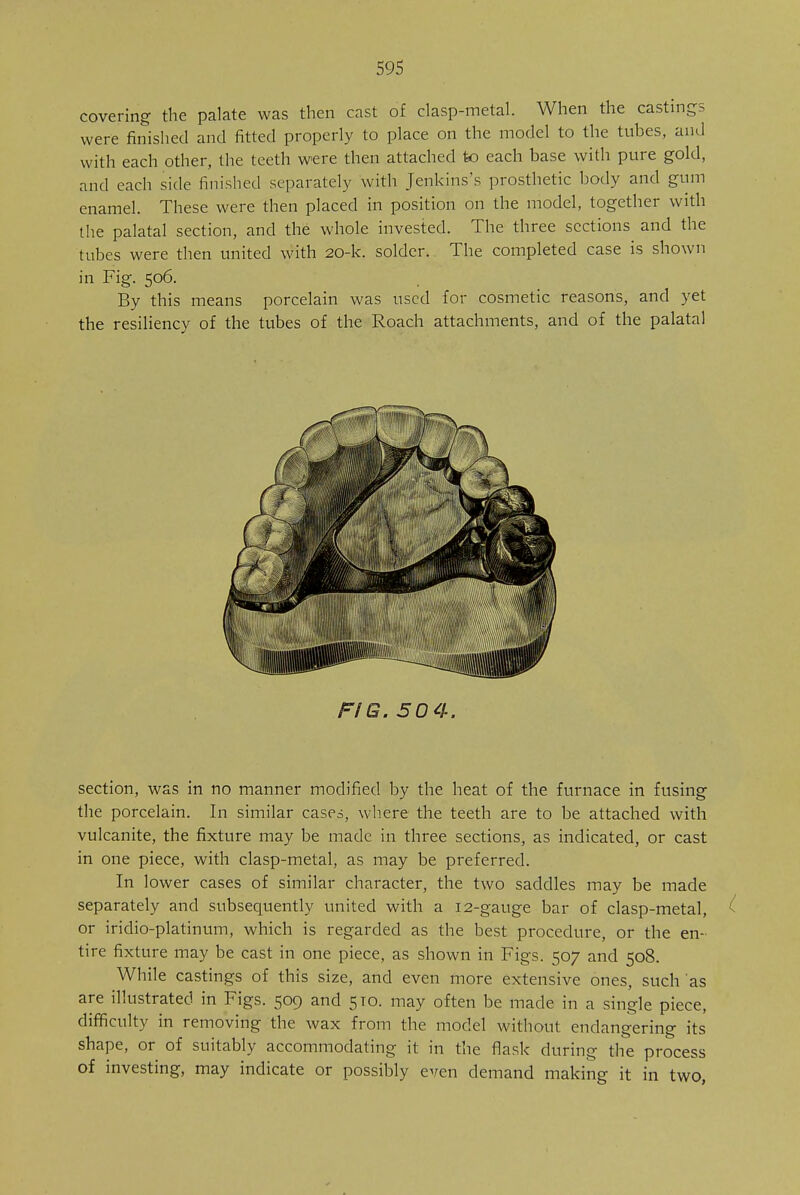 covering the palate was then cast of clasp-metal. When the castings were finished and fitted properly to place on the model to the tubes, and with each other, the teeth were then attached to each base with pure gold, and each side finished separately with Jenkins's prosthetic body and gum enamel. These were then placed in position on the model, together with the palatal section, and the whole invested. The three sections and the tubes were then united with 20-k. solder. The completed case is shown in Fig. 506. By this means porcelain was used for cosmetic reasons, and yet the resiliency of the tubes of the Roach attachments, and of the palatal FIG. 50 4. section, was in no manner modified by the heat of the furnace in fusing the porcelain. In similar cases, where the teeth are to be attached with vulcanite, the fixture may be made in three sections, as indicated, or cast in one piece, with clasp-metal, as may be preferred. In lower cases of similar character, the two saddles may be made separately and subsequently united with a 12-gauge bar of clasp-metal, ( or iridio-platinum, which is regarded as the best procedure, or the en- tire fixture may be cast in one piece, as shown in Figs. 507 and 508. While castings of this size, and even more extensive ones, such as are illustrated in Figs. 509 and 510. may often be made in a single piece, difficulty in removing the wax from the model without endangering its shape, or of suitably accommodating it in the flask during the process of investing, may indicate or possibly even demand making it in two,