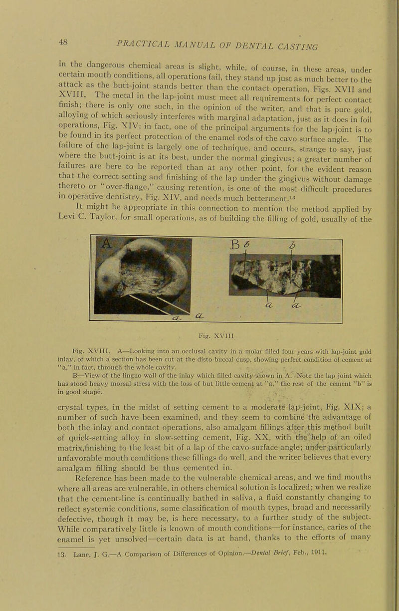 m the dangerous chemical areas is slight, while, of course, in these areas, under certain mouth conditions, all operations fail, they stand up just as much better to the attack as the butt-joint stands bettor than the contact operation. Figs. XVII and XVIII. The metal in the lap-joint must meet all recjuircmcnts for perfect contact hnish; there is only one such, in the opinion of the writer, and that is pure gold alloying of which seriously interferes with marginal adaptation, just as it docs in foil' operations, Fig. XIV; in fact, one of the principal arguments for the lap-joint is to be found in its perfect protection of the enamel rods of the cavo surface angle. The failure of the lap-joint is largely one of technique, and occurs, strange to say, just where the butt-joint is at its best, under the normal gingivus; a greater number of failures are here to be reported than at any other point, for the evident reason that the correct setting and finishing of the lap under the gingivus without damage thereto or over-flange, causing retention, is one of the most difficult procedures in operative dentistry. Fig. XIV, and needs much betterment.i It might be appropriate in this connection to mention the method applied by Levi C. Taylor, for small operations, as of building the filling of gold, usually of the Fig. XVIII Fig. XVIII. A—Looking into an occlusal cavity in a molar filled four years with lap-joint gold inlay, of which a section has been cut at the disto-buccal cusp, showing perfect condition of cement at a, in fact, through the whole cavity. B—View of the linguo wall of the inlay which filled cavity shown in A. Note the lap joint which has stood heavy morsal stress with the loss of but little cement at a, the rest of the cement b is in good shape. ^ crystal types, in the midst of setting cement to a moderate lap-joint. Fig. XIX; a number of such have been examined, and they seem to combine the advantage of both the inlay and contact operations, also amalgam fillings after this method built of quick-setting alloy in slow-setting cement. Fig. XX, with the help of an oiled matrix,finishing to the least bit of a lap of the cavo-surface angle; under particularly unfavorable mouth conditions these fillings do well, and the writer believes that every amalgam filling should be thus cemented in. Reference has been made to the vulnerable chemical areas, and we find mouths where all areas are vulnerable, in others chemical solution is localized; when we realize that the cement-line is continually bathed in saliva, a fluid constantly changing to reflect systemic conditions, some classification of mouth types, broad and necessarily defective, though it may be, is here necessary, to a further study of the subject. While comparatively little is known of mouth conditions—for instance, caries of the enamel is yet unsolved—certain data is at hand, thanks to the efforts of many 13, Lano. J. G.—A Comparison of DilTerences of Opinion—Dfulal Brief, Feb., 1911.