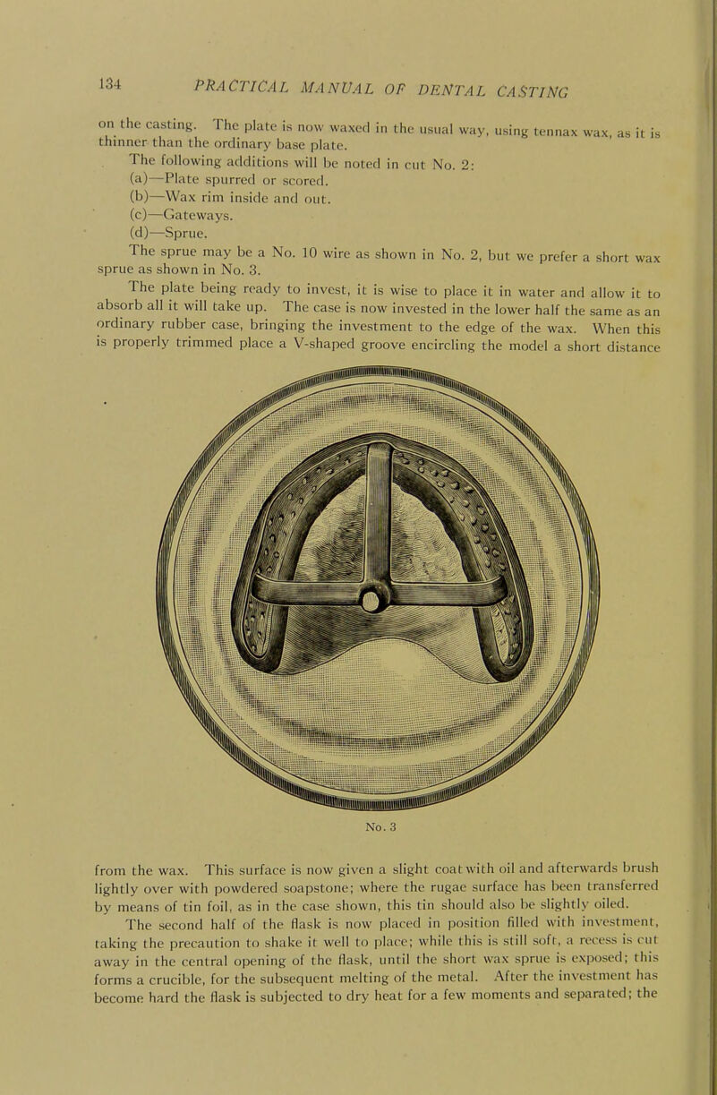 on the casting. The plate is now waxed in the usual way, using tennax wax, as it is thinner than the ordinary base plate. The following additions will be noted in cut No. 2: (a) —Plate spurred or scored. (b) —Wax rim inside and out. (c) —Gateways. (d) —Sprue. The sprue may be a No. 10 wire as shown in No. 2, but we prefer a short wax sprue as shown in No. 3. The plate being ready to invest, it is wise to place it in water and allow it to absorb all it will take up. The case is now invested in the lower half the same as an ordinary rubber case, bringing the investment to the edge of the wax. When this is properly trimmed place a V-shaped groove encircling the model a short distance iiiBimnnii No. 3 from the wax. This surface is now given a slight coat with oil and afterwards brush lightly over with powdered soapstone; where the rugae surface has been transferred by means of tin foil, as in the case shown, this tin should also be slightly oiled. The second half of the flask is now placed in position filled with investment, taking the precaution to shake it well to place; while this is still soft, a recess is cut away in the central opening of the flask, until the short wax sprue is exposed; this forms a crucible, for the subsequent melting of the metal. After the investment has become hard the flask is subjected to dry heat for a few moments and separated; the