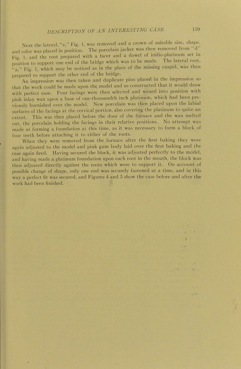 DESCRIPTION OF AN INTERESTING CASE Next the lateral, c, Fig. 1, was removed and a crown of suitable .size, shape, and color was placed in position. The porcelain jacket was then removed from d Fig 1 and the root prepared with a facer and a dowel of indio-platinum set in position to support one end of the bridge which was to be made. The lateral root, a, Fig. 1, which may be noticed as in the place of the missing cuspid, was then prepared to support the other end of the bridge. An impression was then taken and duplicate pins placed in the impression so that the work could be made upon the model and so constructed that it would draw with perfect ease. Four facings were then selected and waxed into position with pink inlay wax upon a base of one-thousandth inch platinum, which had been pre- viously burnished over the model. New porcelain was then placed upon the labial surfaces of the facings at the cervical portion, also covering the platinum to quite an extent. This was then placed before the door of the furnace and the wax melted out, the porcelain holding the facings in their relative positions. No attempt was made at forming a foundation at this time, as it was necessary to form a block of four teeth before attaching it to either of the roots. When they were removed from the furnace after the first baking they were again adjusted to the model and pink gum body laid over the first baking and the case again fired. Having secured the block, it was adjusted perfectly to the model, and having made a platinum foundation upon each root in the mouth, the block was then adjusted directly against the roots which were to support it. On account of possible change of shape, only one end was securely fastened at a time, and in this way a perfect fit was secured, and Figures 4 and 5 show the case before and after the work had been finished. 'ji