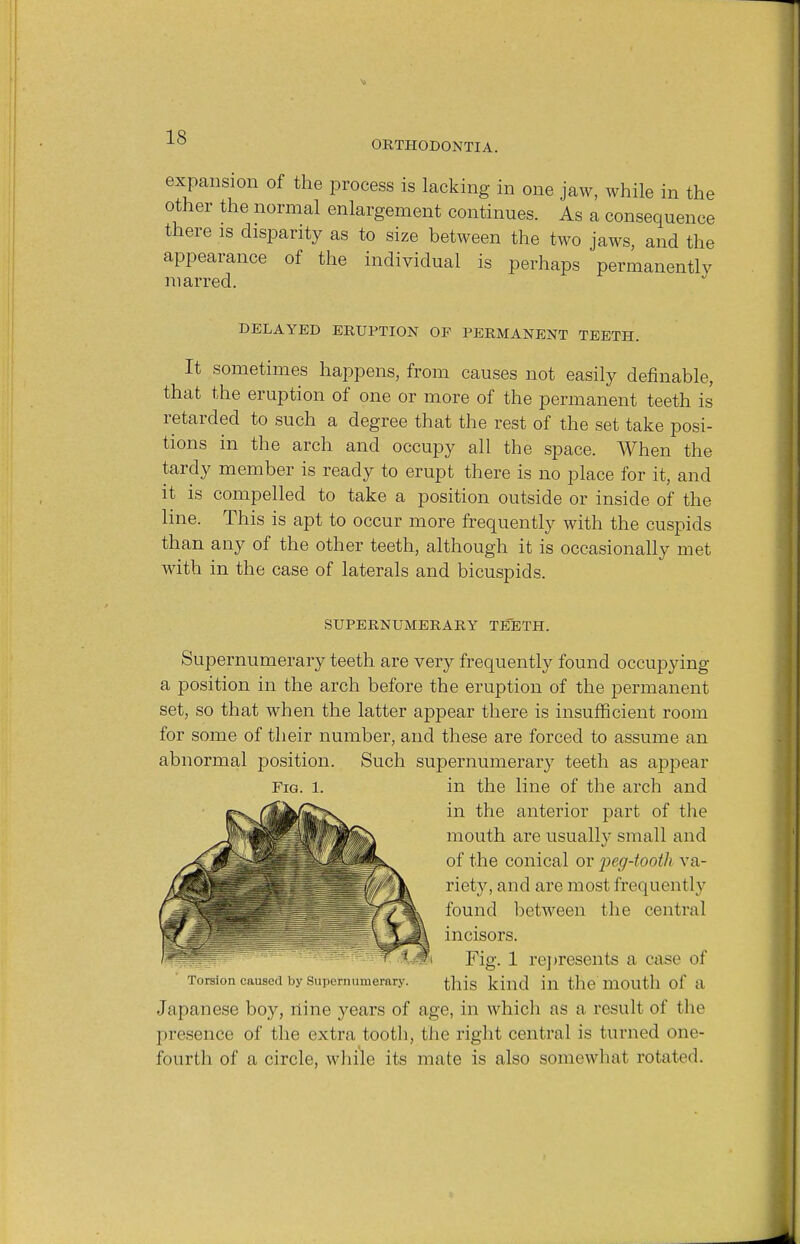 expansion of the process is lacking in one jaw, while in the other the normal enlargement continues. As a consequence there is disparity as to size between the two jaws, and the appearance of the individual is perhaps permanently marred. DELAYED ERUPTION OF PERMANENT TEETH. It sometimes happens, from causes not easily definable, that the eruption of one or more of the permanent teeth is retarded to such a degree that the rest of the set take posi- tions in the arch and occupy all the space. When the tardy member is ready to erupt there is no place for it, and it is compelled to take a position outside or inside of the line. This is apt to occur more frequently with the cuspids than any of the other teeth, although it is occasionally met with in the case of laterals and bicuspids. SUPERNUMERARY TEETH. Supernumerary teeth are very frequently found occupying a position in the arch before the eruption of the permanent set, so that when the latter appear there is insufficient room for some of their number, and these are forced to assume an abnormal position. Such supernumerary teeth as appear Fig. 1. in the line of the arch and in the anterior part of the mouth are usually small and of the conical or peg-tooth va- riety, and are most frequently found between the central incisors. Fig. 1 re]tresents a case of Torsion caused by Supernumerary. this kind ill the UlOlltll of 8 Japanese boy, nine years of age, in which as a result of the presence of the extra tooth, the right central is turned one- fourth of a circle, while its mate is also somewhat rotated.