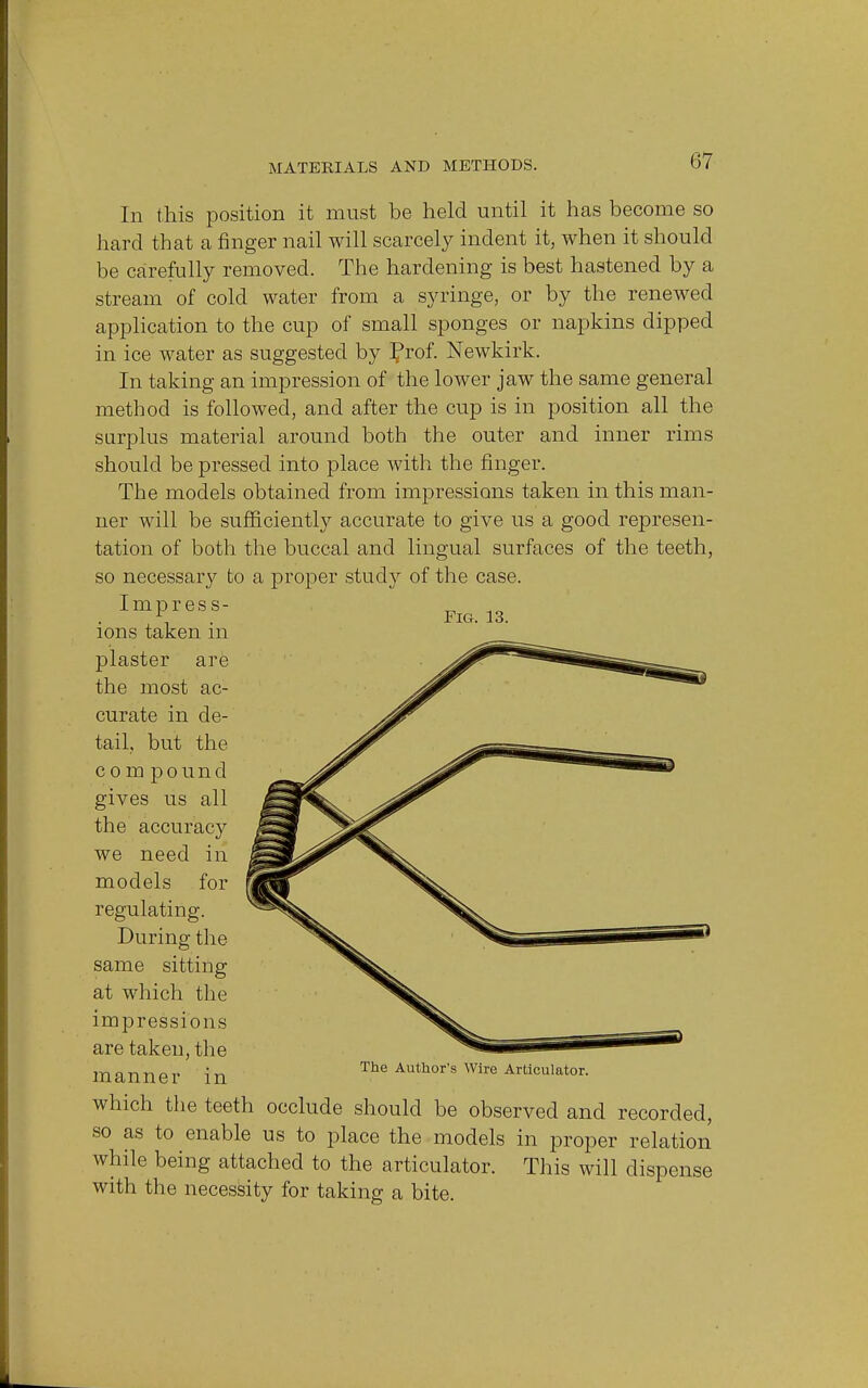 In this position it must be held until it has become so hard that a finger nail will scarcely indent it, when it should be carefully removed. The hardening is best hastened by a stream of cold water from a syringe, or by the renewed application to the cup of small sponges or napkins dipped in ice water as suggested by frof. Newkirk. In taking an impression of the lower jaw the same general method is followed, and after the cup is in position all the surplus material around both the outer and inner rims should be pressed into place with the finger. The models obtained from impressions taken in this man- ner will be sufficiently accurate to give us a good represen- tation of both the buccal and lingual surfaces of the teeth, so necessary to a proper study of the case. Impress- ions taken in plaster are the most ac- curate in de- tail, but the com pound gives us all the accuracy we need in models for regulating. During the same sitting at which the impressions are taken, the manner in Fig. 13. The Author's Wire Articulator. which the teeth occlude should be observed and recorded, so as to enable us to place the models in proper relation while being attached to the articulator. This will dispense with the necessity for taking a bite.