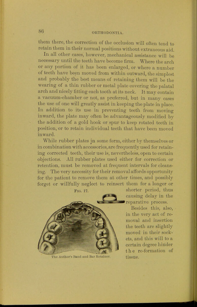 ORTHODONTI A. them there, the correction of the occlusion will often tend to retain them in their normal positions without extraneous aid. In all other cases, however, mechanical assistance will be necessary until the teeth have become firm. Where the arch or any portion of it has been enlarged, or where a number of teeth have been moved from within outward, the simplest and probably the best means of retaining them will be the wearing of a thin rubber or metal plate covering the palatal arch and nicely fitting each tooth at its neck. It may contain a vacuum-chamber or not, as preferred, but in many cases the use of one will greatly assist in keeping the plate in place. In addition to its use in preventing teeth from moving inward, the plate may often be advantageously modified by the addition of a gold hook or spur to keep rotated teeth in position, or to retain individual teeth that have been moved inward. While rubber plates in some form, either by themselves or in combination with accessories, are frequently used for retain- ing corrected teeth, their use is, nevertheless, open to certain objections. All rubber plates used either for correction or retention, must be removed at frequent intervals for cleans- ing. The very necessity for their removal affords opportunity for the patient to remove them at other times, and possibly forget or willfully neglect to reinsert them for a longer or Fig. 17. The Author's Hand and Bar Retainer. shorter period, thus causing delay in the reparative process. Besides this, also, in the very act of re- moval and insertion the teeth are slightly moved in their sock- ets, and this will to a certain degree hinder the re-formation of tissue.
