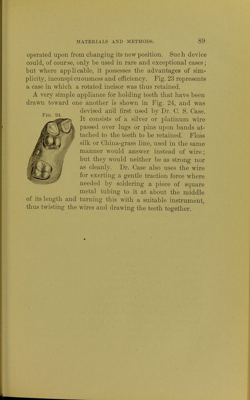 operated upon from changing its new position. Such device could, of course, only be used in rare and exceptional cases; but where applicable, it possesses the advantages of sim- plicity, inconspicuousness and efficiency. Fig. 23 represents a case in which a rotated incisor was thus retained. A very simple appliance for holding teeth that have been drawn toward one another is shown in Fig. 24, and was devised and first used by Dr. C. S. Case. It consists of a silver or platinum wire passed over lugs or pins upon bands at- tached to the teeth to be retained. Floss silk or China-grass line, used in the same manner would answer instead of wire; but they would neither be as strong nor as cleanly. Dr. Case also uses the wire for exerting a gentle traction force where needed by soldering a piece of square metal tubing to it at about the middle of its length and turning this with a suitable instrument, thus twisting the wires and drawing the teeth together.