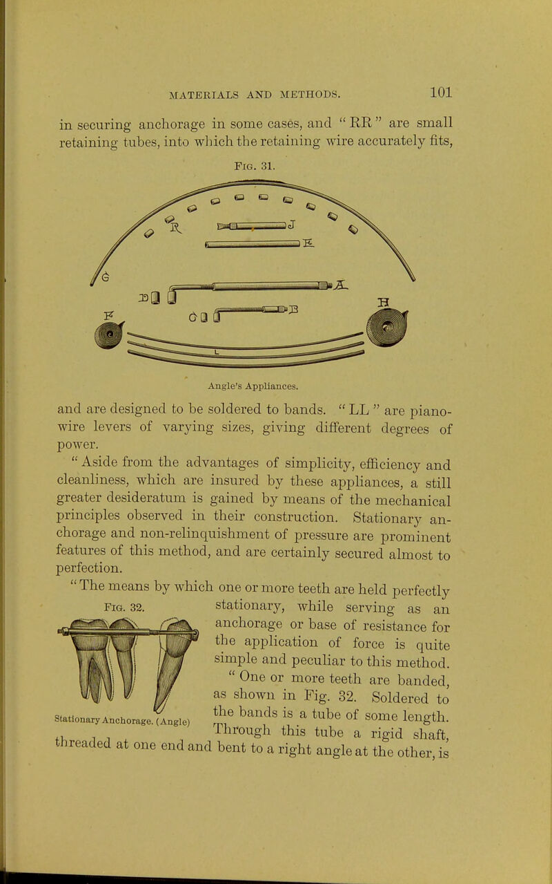in securing anchorage in some cases, and EE, are small retaining tubes, into which the retaining wire accurately fits, Fig. 31. Angle's Appliances. and are designed to be soldered to bands.  LL  are piano- wire levers of varying sizes, giving different degrees of power.  Aside from the advantages of simplicity, efficiency and cleanliness, which are insured by these appliances, a still greater desideratum is gained by means of the mechanical principles observed in their construction. Stationary an- chorage and non-relinquishment of pressure are prominent features of this method, and are certainly secured almost to perfection. The means by which one or more teeth are held perfectly Fig. 32. stationary, while serving as an anchorage or base of resistance for the application of force is quite simple and peculiar to this method.  One or more teeth are banded, as shown in Fig. 32. Soldered to Stationary Anchorage. ^ngle) 2f ban,ds 18 E tube °f *Ome length. +v , . Ihrough this tube a rigid shaft, threaded at one end and bent to a right angle at the other, is