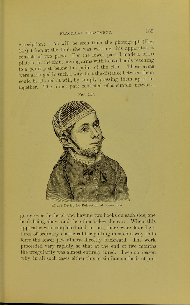 description: As will be seen from the photograph (Fig. 142) taken at the time she was wearing this apparatus, it consists of two parts. For the lower part, I made a brass plate to fit the chin, having arms with hooked ends reaching to a point just below the point of the chin. These arms were arranged in such a way, that the distance between them could be altered at will, by simply pressing them apart or together. The upper part consisted of a simple network, Fig. 142. Allen's Device for Retraction of Lower Jaw. going over the head and having two hooks on each side, one hook being above and the other below the ear. When this apparatus was completed and in use, there were four liga- tures of ordinary elastic rubber pulling in such a way as to force the lower jaw almost directly backward. The work proceeded very rapidly, so that at the end of two months the irregularity was almost entirely cured. I see no reason why, in all such cases, either this or similar methods of pro-