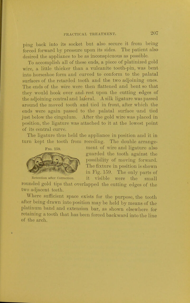 PRACTICAL THE ATM ENT. ping back into its socket but also secure it from being forced forward by pressure upon its sides. The patient also desired the appliance to be as inconspicuous as possible. To accomplish all of these ends, a piece of platinized gold wire, a little thicker than a vulcanite tooth-pin, was bent into horseshoe form and curved to conform to the palatal surfaces of the retarded tooth and the two adjoining ones. The ends of the wire were then flattened and bent so that they would hook over and rest upon the cutting edges of the adjoining central and lateral. A silk ligature was passed around the moved tooth and tied in front, after which the ends were again passed to the palatal surface -and tied just below the cingulum. After the gold wire was placed in position, the ligature was attached to it at the lowest point of its central curve. The ligature thus held the appliance in position and it in turn kept the tooth from receding. The double arrange- rs. 159. ment of wire and ligature also guarded the tooth against the possibility of moving forward. The fixture in position is shown in Fig. 159. The only parts of Retention after Correction. it visible Were the Small rounded gold tips that overlapped the cutting edges of the two adjacent teeth. Where sufficient space exists for the purpose, the tooth after being drawn into position may be held by means of the platinum band and extension bar, as shown elsewhere for retaining a tooth that has been forced backward into the line of the arch.