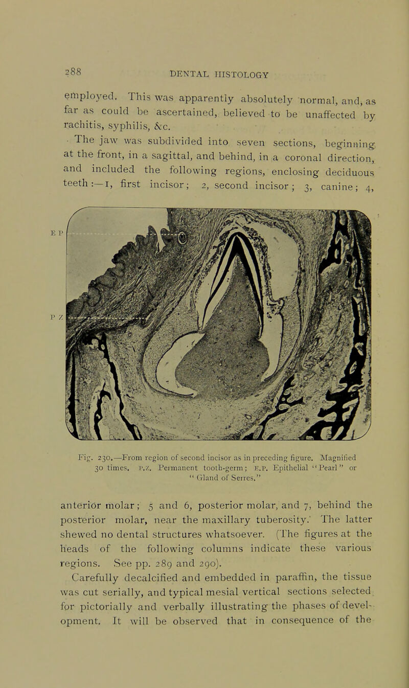 employed. This was apparently absolutely normal, and, as far cis could be ascertained, believed to be unaffected by rachitis, syphilis, &c. The jaw was subdivided into seven sections, beginning: at the front, in a sagittal, and behind, in a coronal direction, and included the following regions, enclosing deciduous teeth:—I, first incisor; 2, second incisor; 3, canine; 4, Fi^. 230.—From region of second incisor as in preceding figure. Magnified 30 times, p.z. Permanent tooth-germ; e.p. Epithelial ''Pearl or  Gland of Serres. anterior molar; 5 and 6, posterior molar, and 7, behind the posterior molar, near the maxillary tuberosity.' The latter shewed no dental structures whatsoever. (The figures at the heads of the following columns indicate these various regions. See pp. 289 and 290). Carefully decalcified and embedded in parafiin, the tissue was cut serially, and typical mesial vertical sections selected for pictorially and verbally illustrating the phases of devel- opment. It will be observed that in consequence of the