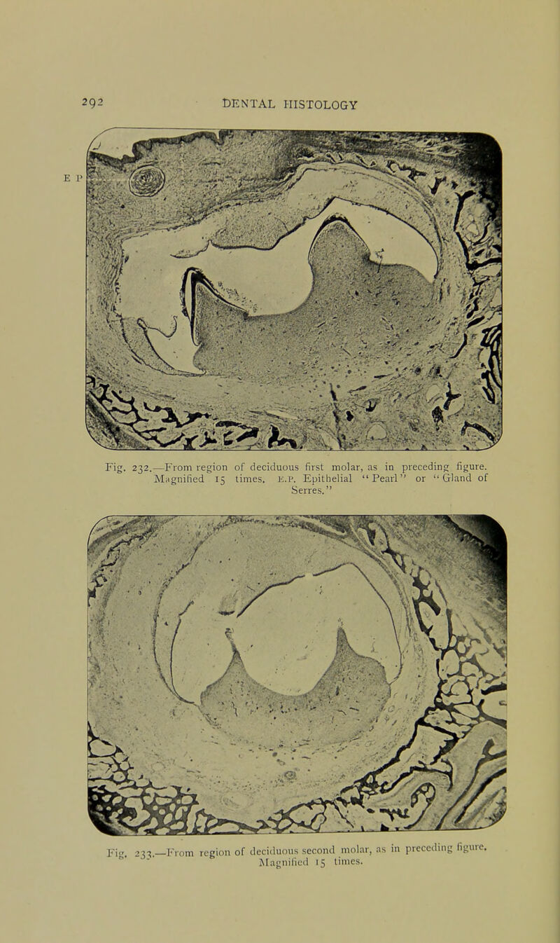 ¥i. 23-^.—]Mom region of deciduous second molar, as in preceding fig ' jNLngiiified 15 limes.