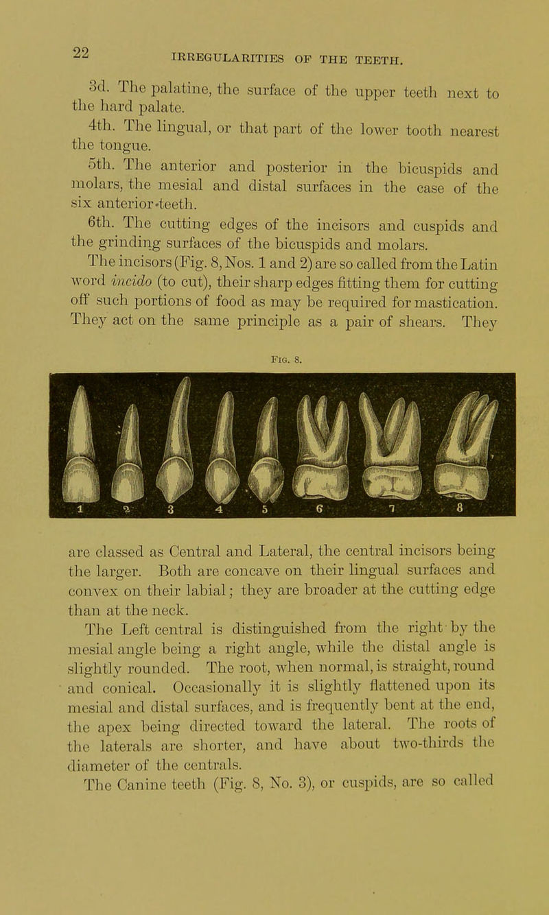 IRREGULARITIES OP THE TEETH. 3d. The palatine, the surface of the upper teeth next to the hard palate. 4th. The lingual, or that part of the lower tooth nearest the tongue. 5th. The anterior and posterior in the bicuspids and molars, the mesial and distal surfaces in the case of the ■six anterior«teeth. 6th. The cutting edges of the incisors and cuspids and the grinding surfaces of the bicuspids and molars. The incisors (Fig. 8, Nos. 1 and 2) are so called from the Latin word incido (to cut), their sharp edges fitting them for cutting off such portions of food as may be required for mastication. They act on the same principle as a pair of shears. They Fig. 8. are classed as Central and Lateral, the central incisors being the larger. Both are concave on their lingual surfaces and convex on their labial; they are broader at the cutting edge than at the neck. The Left central is distinguished from the right by the mesial angle being a right angle, while the distal angle is slightly rounded. The root, when normal,is straight, round and conical. Occasionally it is slightly flattened upon its mesial and distal surfaces, and is frequently bent at the end. the apex being directed toward the lateral. The roots of (lie laterals are shorter, and have about two-thirds the diameter of the centrals. The Canine teeth (Fig. 8, No. 3), or cuspids, are so called