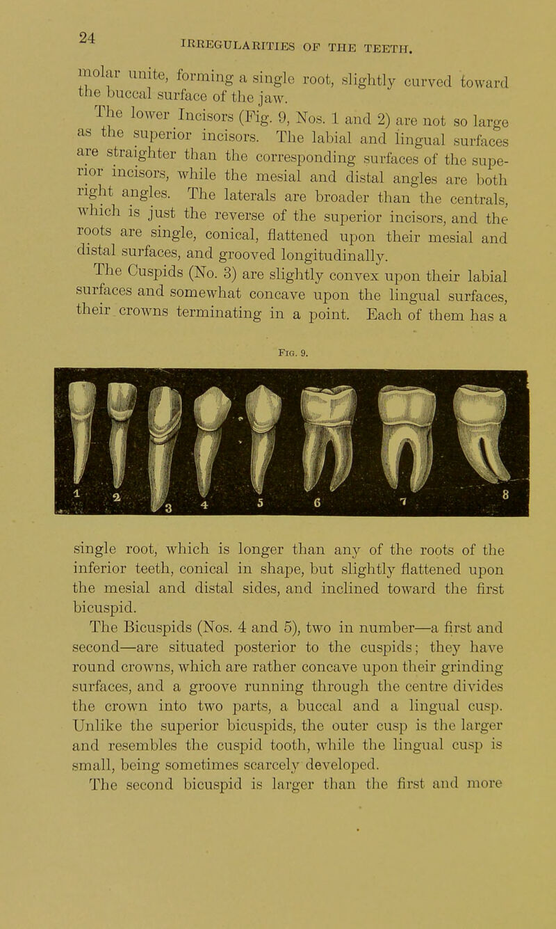 IRREGULARITIES OF THE TEETH. molar unite, forming a single root, slightly curved toward the buccal surface of the jaw. The lower Incisors (Fig. 9, Nos. 1 and 2) are not so large as the superior incisors. The labial and lingual surfaces are straighter than the corresponding surfaces of the supe- rior incisors, while the mesial and distal angles are both right angles. The laterals are broader than the centrals, which is just the reverse of the superior incisors, and the roots are single, conical, flattened upon their mesial and distal surfaces, and grooved longitudinally. The Cuspids (No. 3) are slightly convex upon their labial surfaces and somewhat concave upon the lingual surfaces, their crowns terminating in a point. Each of them has a Fig. 9. single root, which is longer than any of the roots of the inferior teeth, conical in shape, but slightly flattened upon the mesial and distal sides, and inclined toward the first bicuspid. The Bicuspids (Nos. 4 and 5), two in number—a first and second—are situated posterior to the cuspids; they have round crowns, which are rather concave upon their grinding surfaces, and a groove running through the centre divides the crown into two parts, a buccal and a lingual cusp. Unlike the superior bicuspids, the outer cusp is the larger and resembles the cuspid tooth, while the lingual cusp is small, being sometimes scarcely developed. The second bicuspid is larger than the first and more