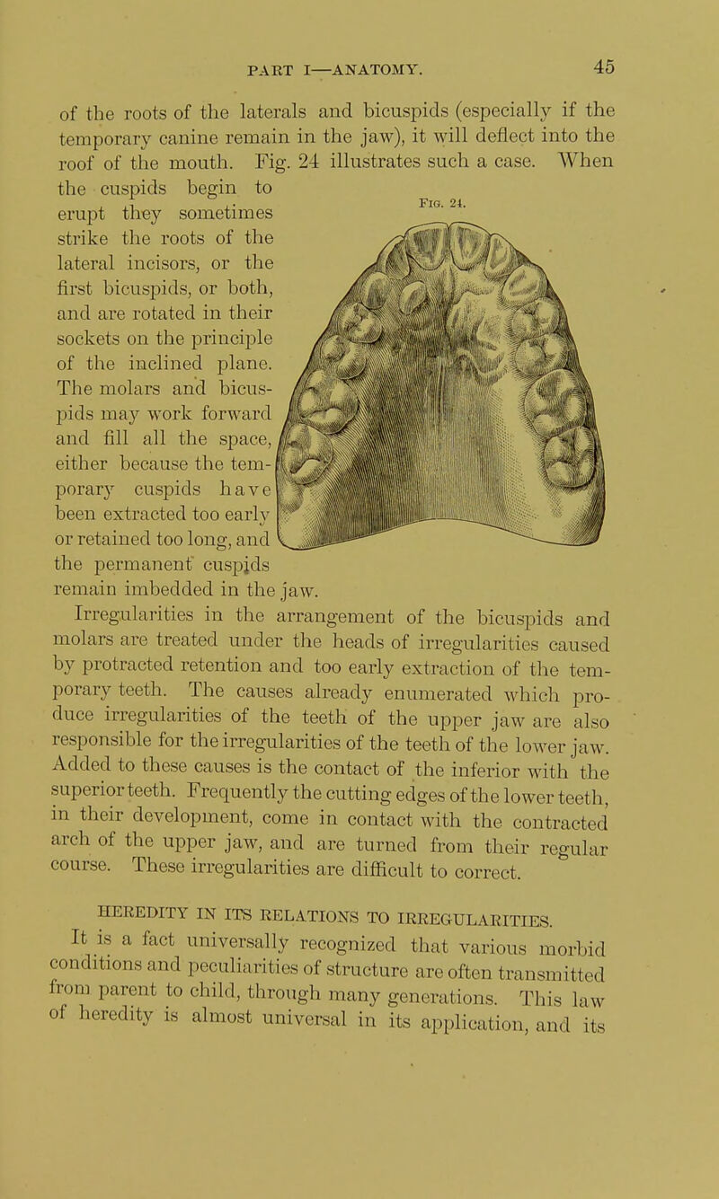 of the roots of the laterals and bicuspids (especially if the temporary canine remain in the jaw), it will deflect into the roof of the mouth. Fig. 24 illustrates such a case. When the cuspids begin to Fig. 24. erupt they sometimes strike the roots of the lateral incisors, or the first bicuspids, or both, and are rotated in their sockets on the principle of the inclined plane. The molars and bicus- pids may work forward and fill all the space, either because the tem- porary cuspids have been extracted too early Or retained too long, and the permanent cuspjds remain imbedded in the jaw. Irregularities in the arrangement of the bicuspids and molars are treated under the heads of irregularities caused by protracted retention and too early extraction of the tem- porary teeth. The causes already enumerated which pro- duce irregularities of the teeth of the upper jaw are also responsible for the irregularities of the teeth of the lower jaw. Added to these causes is the contact of the inferior with the superior teeth. Frequently the cutting edges of the lower teeth, in their development, come in contact with the contracted arch of the upper jaw, and are turned from their regular course. These irregularities are difficult to correct. HEREDITY IN ITS RELATIONS TO IRREGULARITIES. It is a fact universally recognized that various morbid conditions and peculiarities of structure are often transmitted from parent to child, through many generations. This law of heredity is almost universal in its application, and its