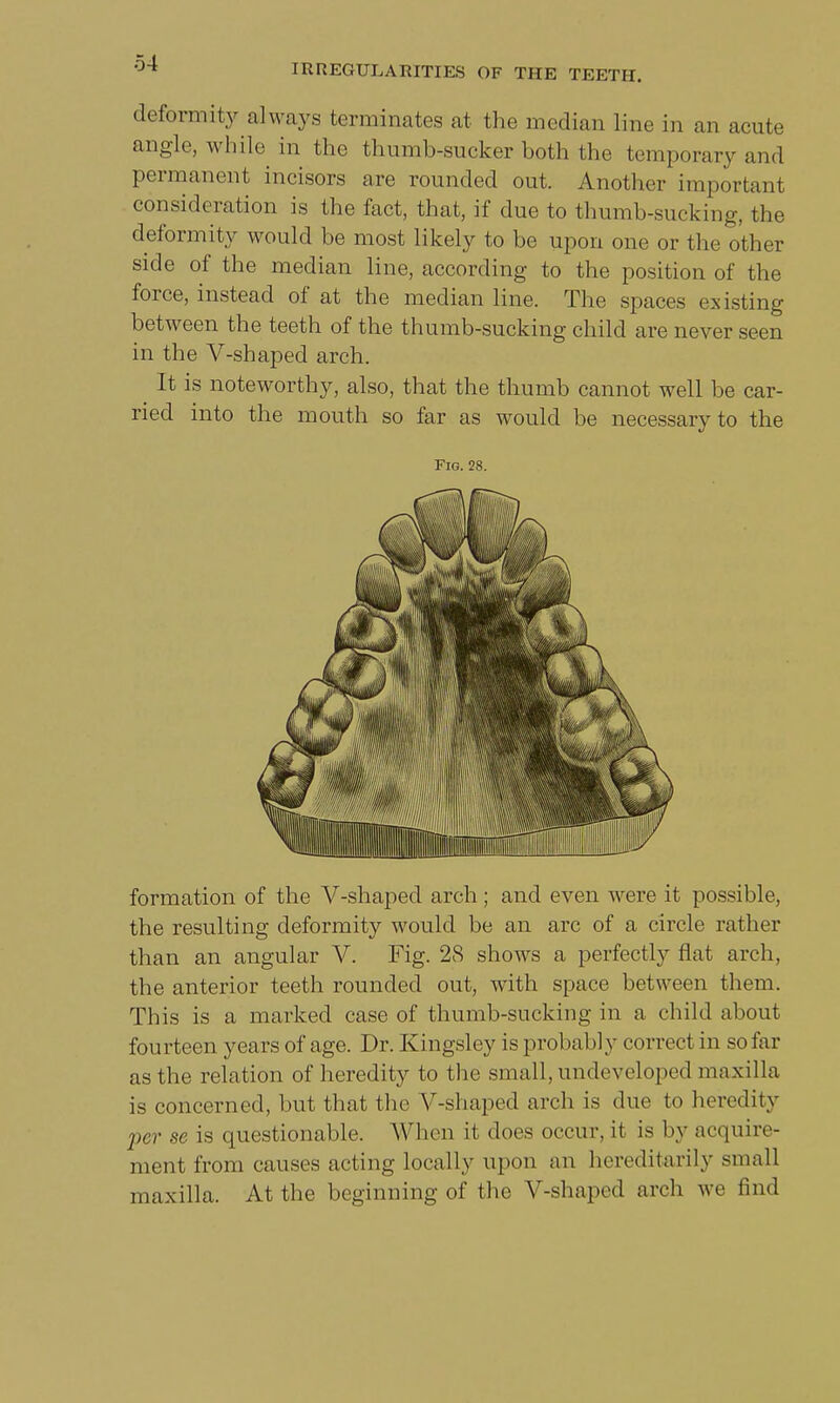 deformity always terminates at the median line in an acute angle, while in the thumb-sucker both the temporary and permanent incisors are rounded out. Another important consideration is the fact, that, if due to thumb-sucking, the deformity would be most likely to be upon one or the other side of the median line, according to the position of the force, instead of at the median line. The spaces existing between the teeth of the thumb-sucking child are never seen in the V-shaped arch. It is noteworthy, also, that the thumb cannot well be car- ried into the mouth so far as would be necessary to the Fig. 28. formation of the V-shaped arch ; and even were it possible, the resulting deformity would be an arc of a circle rather than an angular V. Fig. 28 shows a perfectly flat arch, the anterior teeth rounded out, with space between them. This is a marked case of thumb-sucking in a child about fourteen years of age. Dr. Kingsley is probal >ly correct in so far as the relation of heredity to the small, undeveloped maxilla is concerned, but that the V-shaped arch is due to heredity 2>cr se is questionable. When it does occur, it is by acquire- ment from causes acting locally niton an hereditarily small maxilla. At the beginning of the V-shaped arch we find