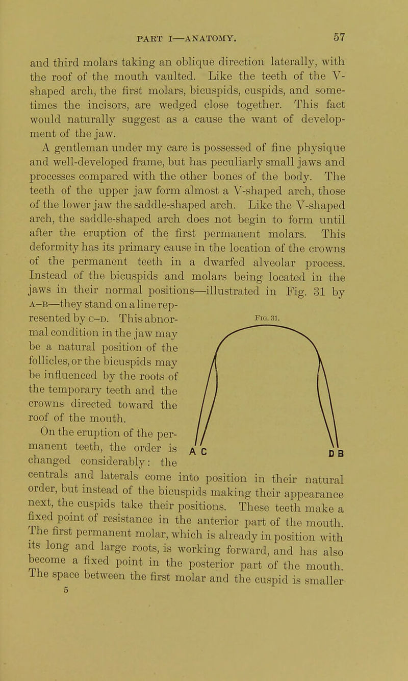 and third molars taking an oblique direction laterally, with the roof of the mouth vaulted. Like the teeth of the V- shaped arch, the first molars, bicuspids, cuspids, and some- times the incisors, are wedged close together. This fact would naturally suggest as a cause the want of develop- ment of the jaw. A gentleman under my care is possessed of fine physique and well-developed frame, but has peculiarly small jaws and processes compared with the other bones of the body. The teeth of the upper jaw form almost a V-shaped arch, those of the lower jaw the saddle-shaped arch. Like the V-shaped arch, the saddle-shaped arch does not begin to form until after the eruption of the first permanent molars. This deformity has its primary cause in the location of the crowns of the permanent teeth in a dwarfed alveolar process. Instead of the bicuspids and molars being located in the jaws in their normal positions—illustrated in Fig. 31 by a-b—they stand on a line rep- resented by c-d. This abnor- fig. 31. mal condition in the jaw may be a natural position of the follicles, or the bicuspids may be influenced by the roots of the temporary teeth and the crowns directed toward the roof of the mouth. On the eruption of the per- manent teeth, the order is changed considerably: the centrals and laterals come into position in their natural order, but instead of the bicuspids making their appearance next, the cuspids take their positions. These teeth make a fixed point of resistance in the anterior part of the mouth The first permanent molar, which is already in position with its long and large roots, is working forward, and has also become a fixed point in the posterior part of the mouth, lhe space between the first molar and the cuspid is smaller 5 D Q