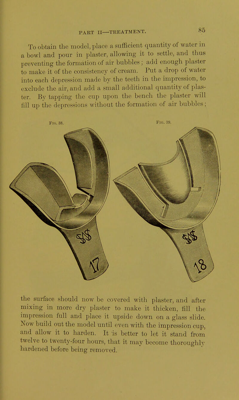 To obtain the model, place a sufficient quantity of water in a bowl and pour in plaster, allowing it to settle, and thus preventing the formation of air bubbles ; add enough plaster to make it of the consistency of cream. Put a drop of water into each depression made by the teeth in the impression, to exclude the air, and add a small additional quantity of plas- ter. By tapping the cup upon the bench the plaster will fill up the depressions without the formation of air bubbles; Fig. 38. Fig. 39. the surface should now be covered with plaster, and after mixing in more dry plaster to make it thicken, fill the impression full and place it upside down on a glass slide. Now build out the model until even with the impression cup, and allow it to harden. It is better to let it stand from twelve to twenty-four hours, that it may become thoroughly hardened before being removed.