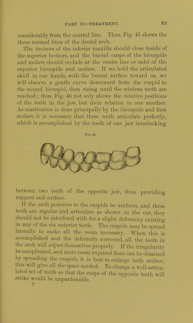 considerably from the central line. Thus, Fig. 45 shows the three normal lines of the dental arch. The incisors of the inferior maxilla should close inside of the superior incisors, and the buccal cusps of the bicuspids and molars should occlude at the centre line or sulci of the superior bicuspids and molars. If we hold the articulated skull in our hands, with the buccal surface toward us, we will observe a gentle curve downward from the cuspid to the second bicuspid, then rising until the wisdom teeth are reached; thus, Fig. 46 not only shows the relative positions of the teeth in the jaw, but their relation to one another. As mastication is done principally by the bicuspids and first molars, it is necessary that these teeth articulate perfectly, which is accomplished by the tooth of one jaw interlocking Fig. 46. between two teeth of the opposite jaw, thus providing support and surface. If the arch posterior to the cuspids be uniform, and these teeth are regular and articulate as shown in the cut, they should not be interfered with for a slight deformity existing in any of the six anterior teeth. The cuspids may be spread laterally to make all the room necessary. When this is accomplished and the deformity corrected, all the teeth in the arch will adjust themselves properly. If the irregularity be complicated, and more room required than can be obtained by spreading the cuspids, it is best to enlarge both arches ■ this will give all the space needed. To change a well-articu- lated set of teeth so that the cusps of the opposite teeth will strike would he unpardonable. 7
