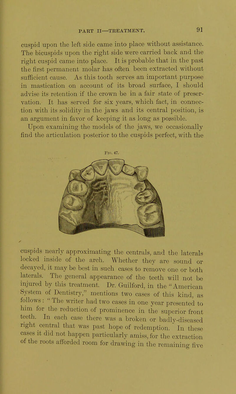 cuspid upon the left side came into place without assistance. The bicuspids upon the right side were carried back and the right cuspid came into place. It is probable that in the past the first permanent molar has often been extracted without sufficient cause. As this tooth serves an important purpose in mastication on account of its broad surface, I should advise its retention if the crown be in a fair state of preser- vation. It has served for six years, which fact, in connec- tion with its solidity in the jaws and its central position, is an argument in favor of keeping it as long as possible. Upon examining the models of the jaws, we occasionally find the articulation posterior to the cuspids perfect, with the Fm. 47. cuspids nearly approximating the centrals, and the laterals locked inside of the arch. Whether they are sound or decayed, it may be best in such cases to remove one or both laterals. The general appearance of the teeth will not be injured by this treatment. Dr. Guilford, in the American System of Dentistry, mentions two cases of this kind, as follows :  The writer had two cases in one year presented to him for the reduction of prominence in the superior front teeth. In each case there was a broken or badly-diseased right central that was past hope of redemption. In these cases it did not happen particularly amiss,for the extraction of the roots afforded room for drawing in the remaining five