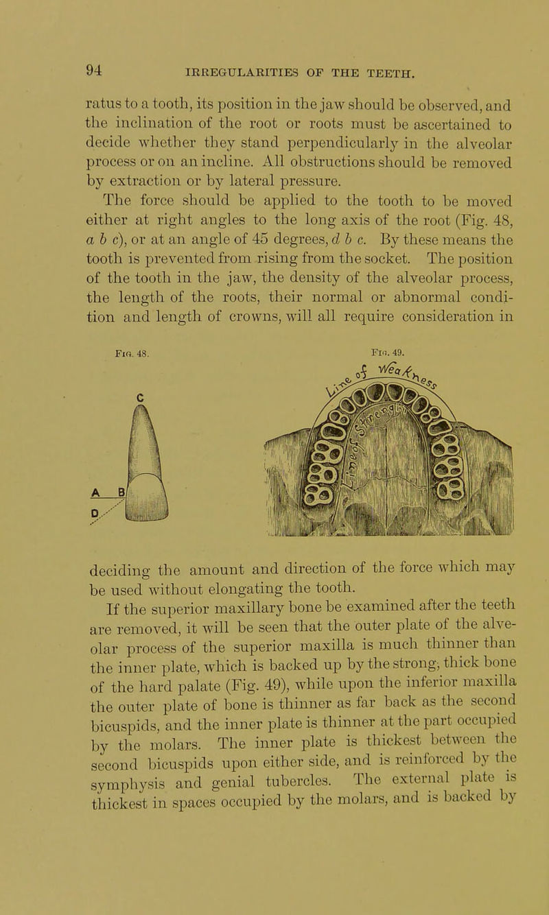 ratus to a tooth, its position in the jaw should be observed, and the inclination of the root or roots must be ascertained to decide whether they stand perpendicularly in the alveolar process or on an incline. All obstructions should be removed by extraction or by lateral pressure. The force should be applied to the tooth to be moved either at right angles to the long axis of the root (Fig. 48, a b c), or at an angle of 45 degrees, d b c. By these means the tooth is prevented from rising from the socket. The position of the tooth in the jaw, the density of the alveolar process, the length of the roots, their normal or abnormal condi- tion and length of crowns, will all require consideration in deciding the amount and direction of the force which may be used without elongating the tooth. If the superior maxillary bone be examined after the teeth are removed, it will be seen that the outer plate of the alve- olar process of the superior maxilla is much thinner than the inner plate, which is backed up by the strongs thick bone of the hard palate (Fig. 49), while upon the inferior maxilla the outer plate of bone is thinner as far back as the second bicuspids, and the inner plate is thinner at the part occupied by the molars. The inner plate is thickest between the second bicuspids upon either side, and is reinforced by the symphysis and genial tubercles. The external plate is thickest in spaces occupied by the molars, and is backed by