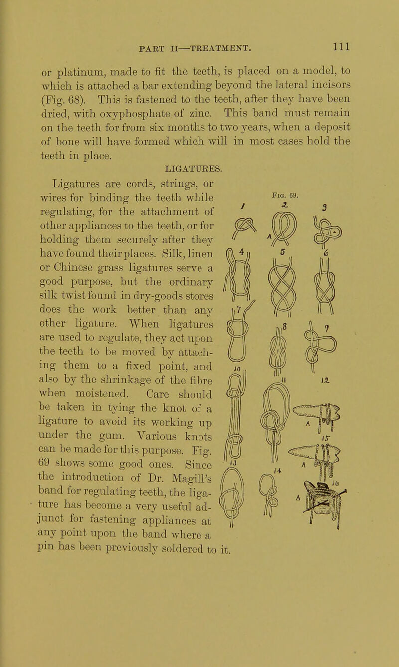 or platinum, made to fit the teeth, is placed on a model, to which is attached a bar extending beyond the lateral incisors (Fig. 68). This is fastened to the teeth, after they have been dried, with oxyphosphate of zinc. This band must remain on the teeth for from six months to two years, when a deposit of bone will have formed which will in most cases hold the teeth in place. LIGATURES. Ligatures are cords, strings, or wires for binding the teeth while regulating, for the attachment of other appliances to the teeth, or for holding them securely after they have found their places. Silk, linen or Chinese grass ligatures serve a good purpose, but the ordinary silk twist found in dry-goods stores does the work better than any other ligature. When ligatures are used to regulate, they act upon the teeth to be moved by attach- ing them to a fixed point, and also by the shrinkage of the fibre when moistened. Care should be taken in tying the knot of a ligature to avoid its working up under the gum. Various knots can be made for this purpose. Fig. 69 shows some good ones. Since the introduction of Dr. MagilPs band for regulating teeth, the liga- ture has become a very useful ad- junct for fastening appliances at any point upon the band where a pin has been previously soldered to it.