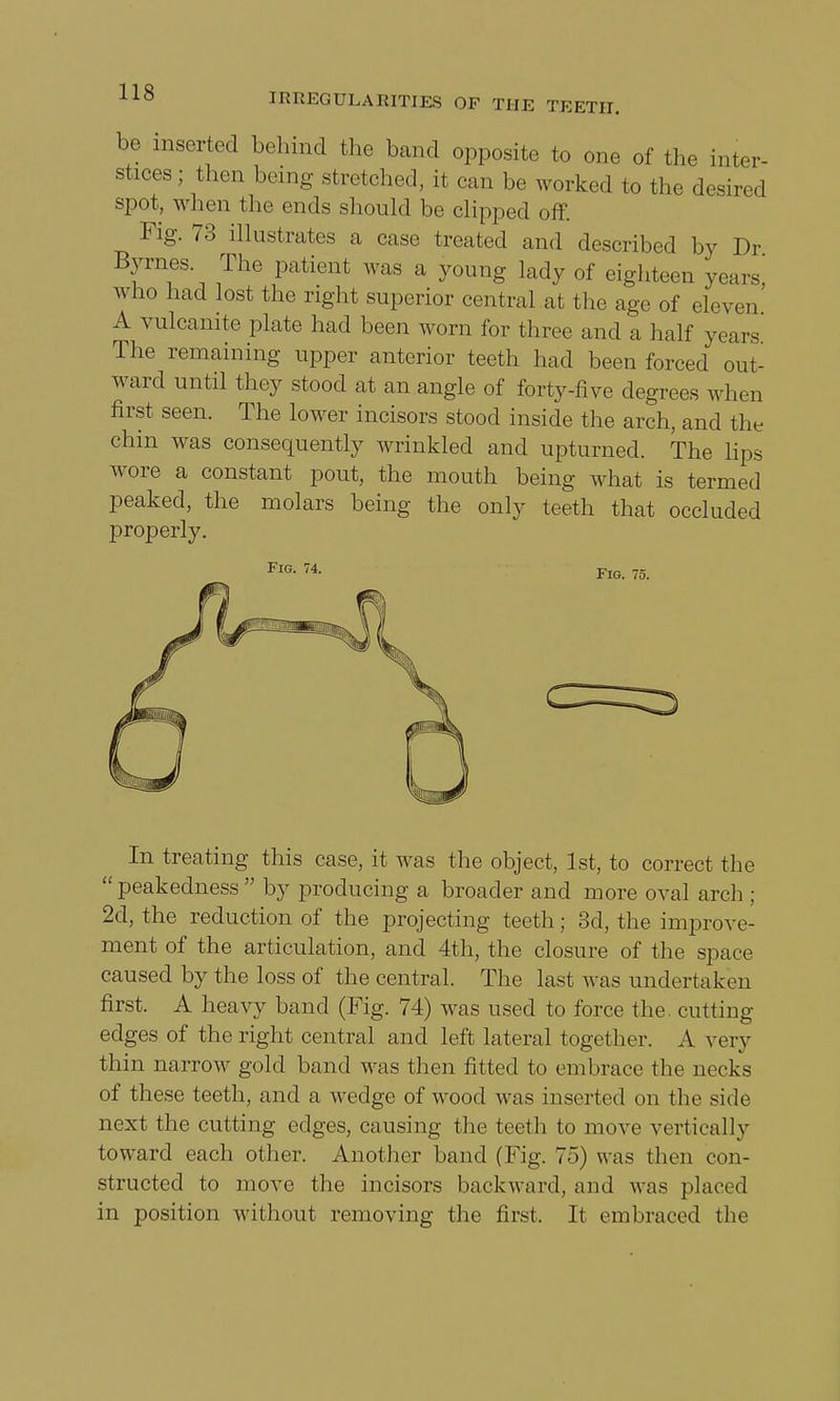 be inserted behind the band opposite to one of the inter- stices ; then being stretched, it can be worked to the desired spot, when the ends should be clipped off. Fig. 73 illustrates a case treated and described by Dr Byrnes. The patient was a young lady of eighteen years' who had lost the right superior central at the age of ele\ A vulcanite plate had been worn for three and a half years The remaining upper anterior teeth had been forced out- ward until they stood at an angle of forty-five degrees when first seen. The lower incisors stood inside the arch, and the chin was consequently wrinkled and upturned. The lips wore a constant pout, the mouth being what is termed peaked, the molars being the only teeth that occluded properly. FlG- 74- Fig. 75. In treating this case, it was the object, 1st, to correct the peakedness by producing a broader and more oval arch ; 2d, the reduction of the projecting teeth; 3d, the improve- ment of the articulation, and 4th, the closure of the space caused by the loss of the central. The last was undertaken first. A heavy band (Fig. 74) was used to force the. cutting edges of the right central and left lateral together. A very thin narrow gold band was then fitted to embrace the necks of these teeth, and a wedge of wood was inserted on the side next the cutting edges, causing the teeth to move vertically toward each other. Another band (Fig. 75) was then con- structed to move the incisors backward, and was placed in position without removing the first. It embraced the