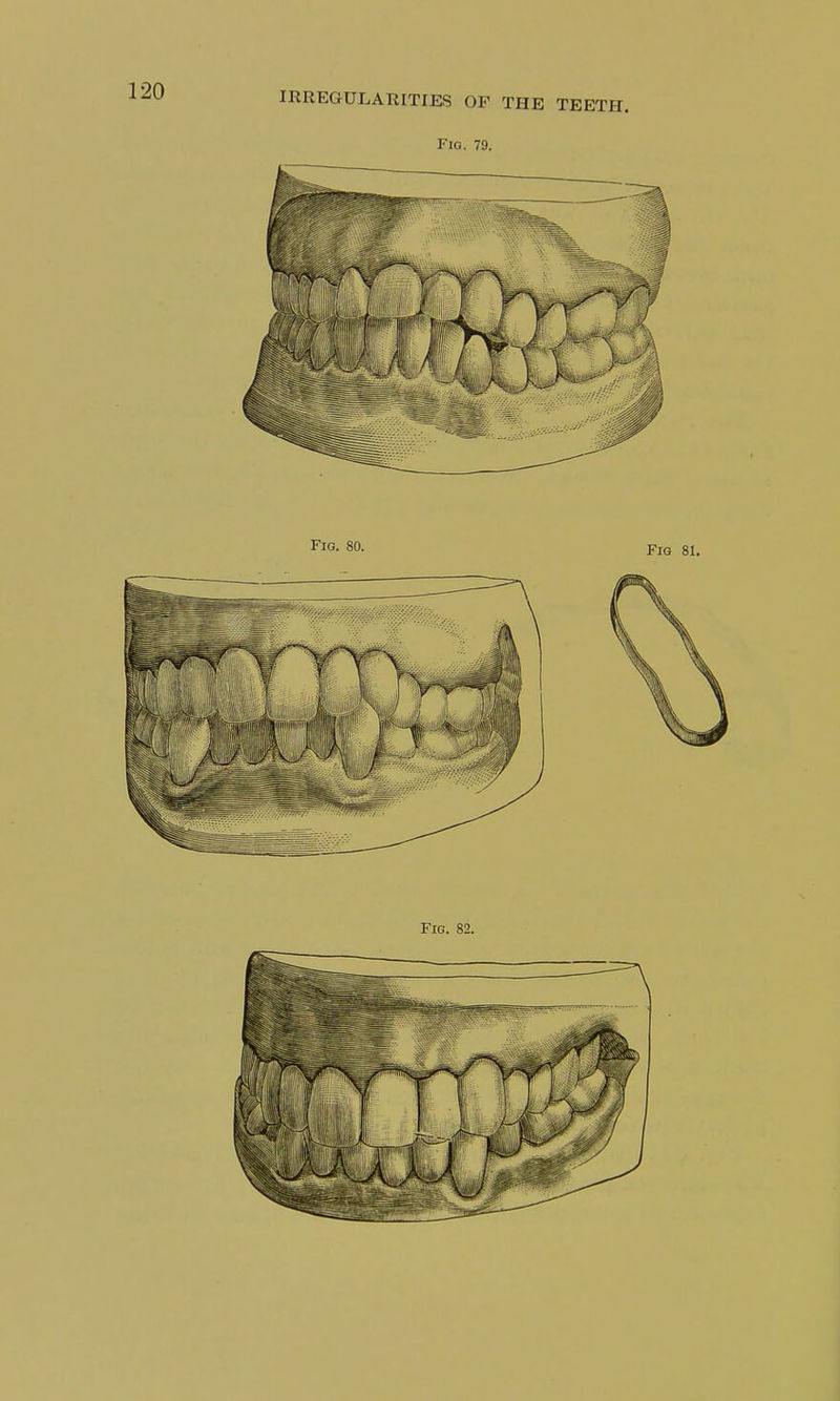 Fig. 79. Fig. 82.