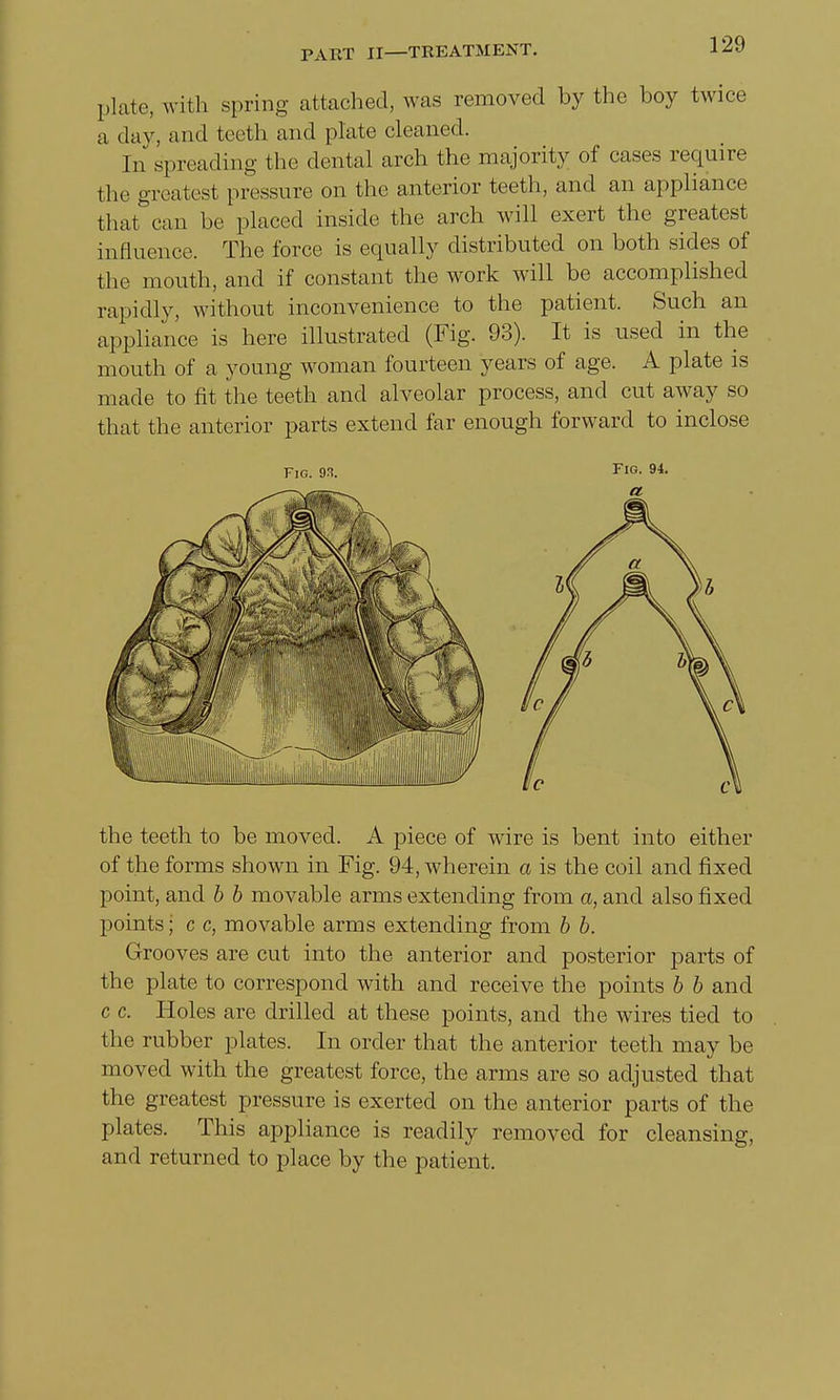 plate, with spring attached, was removed by the boy twice a day, and teeth and plate cleaned. In spreading the dental arch the majority of cases require the greatest pressure on the anterior teeth, and an appliance that can be placed inside the arch will exert the greatest influence. The force is equally distributed on both sides of the mouth, and if constant the work will be accomplished rapidly, without inconvenience to the patient. Such an appliance is here illustrated (Fig. 93). It is used in the mouth of a young woman fourteen years of age. A plate is made to fit the teeth and alveolar process, and cut away so that the anterior parts extend far enough forward to inclose Fig. 93. Fig. 94. the teeth to be moved. A piece of wire is bent into either of the forms shown in Fig. 94, wherein a is the coil and fixed point, and b b movable arms extending from a, and also fixed points; c c, movable arms extending from b b. Grooves are cut into the anterior and posterior parts of the plate to correspond with and receive the points b b and c c. Holes are drilled at these points, and the wires tied to the rubber plates. In order that the anterior teeth may be moved with the greatest force, the arms are so adjusted that the greatest pressure is exerted on the anterior parts of the plates. This appliance is readily removed for cleansing, and returned to place by the patient.