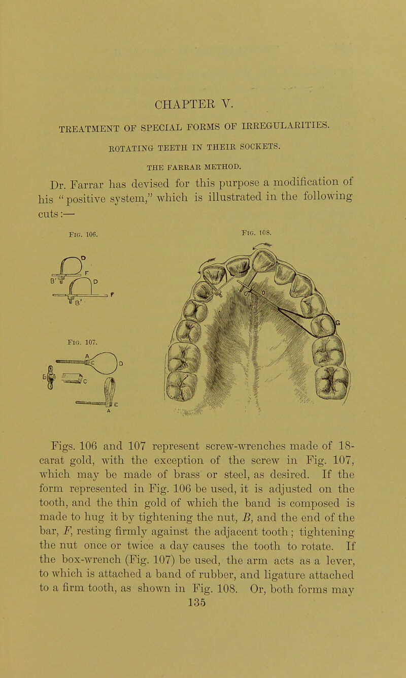 CHAPTER V. TREATMENT OF SPECIAL FORMS OF IRREGULARITIES. ROTATING TEETH IN THEIR SOCKETS. THE FARRAR METHOD. Dr. Farrar has devised for this purpose a modification of his  positive system, which is illustrated in the following- cuts :— Fig. 106. Fig. 108. Figs. 106 and 107 represent screw-wrenches made of 18- carat gold, with the exception of the screw in Fig. 107, which may be made of brass or steel, as desired. If the form represented in Fig. 106 be used, it is adjusted on the tooth, and the thin gold of which the band is composed is made to hug it by tightening the nut, B, and the end of the bar, F, resting firmly against the adjacent tooth; tightening the nut once or twice a day causes the tooth to rotate. If the box-wrench (Fig. 107) be used, the arm acts as a lever, to which is attached a band of rubber, and ligature attached to a firm tooth, as shown in Fig. 108. Or, both forms may