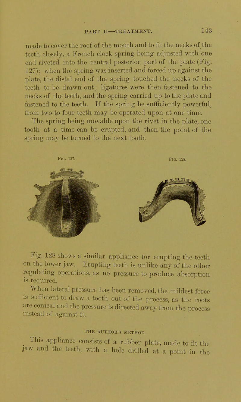 made to cover the roof of the mouth and to fit the necks of the teeth closely, a French clock spring being adjusted with one end riveted into the central posterior part of the plate (Fig. 127); when the spring was inserted and forced up against the plate, the distal end of the spring touched the necks of the teeth to be drawn out; ligatures were then fastened to the necks of the teeth, and the spring carried up to the plate and fastened to the teeth. If the spring be sufficiently powerful, from two to four teeth may be operated upon at one time. The spring being movable upon the rivet in the plate, one tooth at a time can be erupted, and then the point of the spring may be turned to the next tooth. Fie. 127. Fig. 128. Fig. 128 shows a similar appliance for erupting the teeth on the lower jaw. Erupting teeth is unlike any of the other regulating operations, as no pressure to produce absorption is required. When lateral pressure has been removed, the mildest force is sufficient to draw a tooth out of the process, as the roots are conical and the pressure is directed away from the process instead of against it. Tim AUTHOR'S METHOD. This appliance consists of a rubber plate, made to fit the jaw ami the teeth, wit!, a hole drilled at a point in the