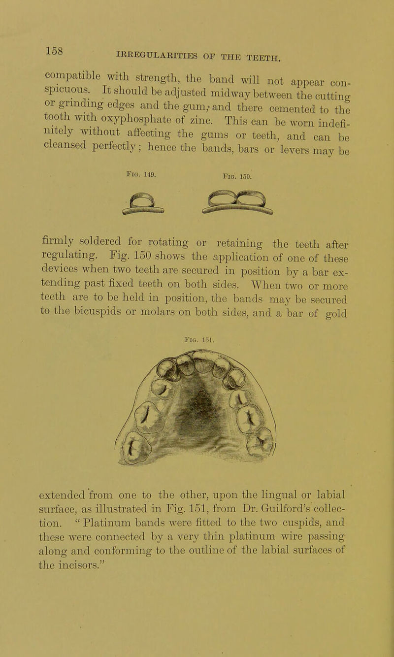 compatible with strength, the band will not appear con- spicuous, rt should be adjusted midway between thecutting or grinding edges and the gum,, and ( hero cemented to the tooth with oxyphosphate of zinc. This can be worn indefi- nitely without affecting the gums or teeth, and can be cleansed perfectly; hence the hands, bars or levers may be Fro. 149. Fig. 150. firmly soldered for rotating or retaining the teeth after regulating. Fig. 150 shows the application of one of these devices when two teeth are secured in position by a bar ex- tending past fixed teeth on both sides. When two or more teeth are to be held in position, the hands may be secured to the bicuspids or molars on both sides, and a bar of gold Fig. 151. extended from one to the other, upon the lingual or labial surface, as illustrated in Fig. 151, from Dr. Guilford's collec- tion. Platinum bands were fitted to the two cuspids, and these were connected by a, very thin platinum wire passing along and conforming to the outline of the labial surfaces of the incisors.